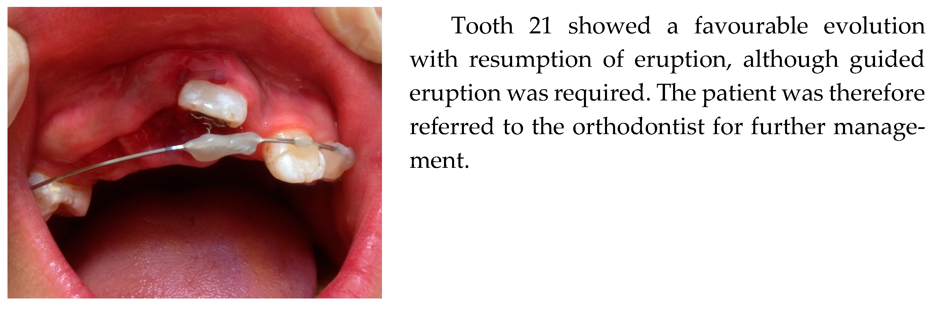 Dentistry 14 00435 g005 Dentistry 14 00435 g005