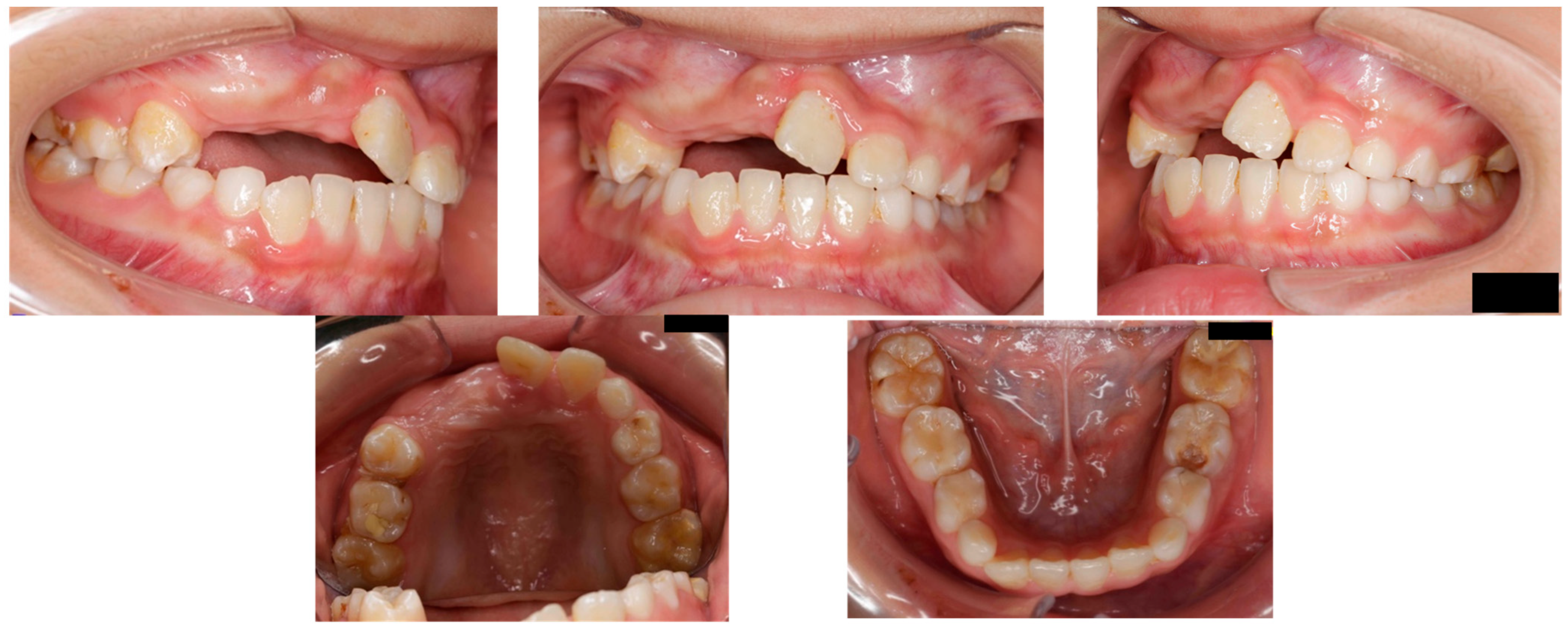 Dentistry 14 00435 g007 Dentistry 14 00435 g007