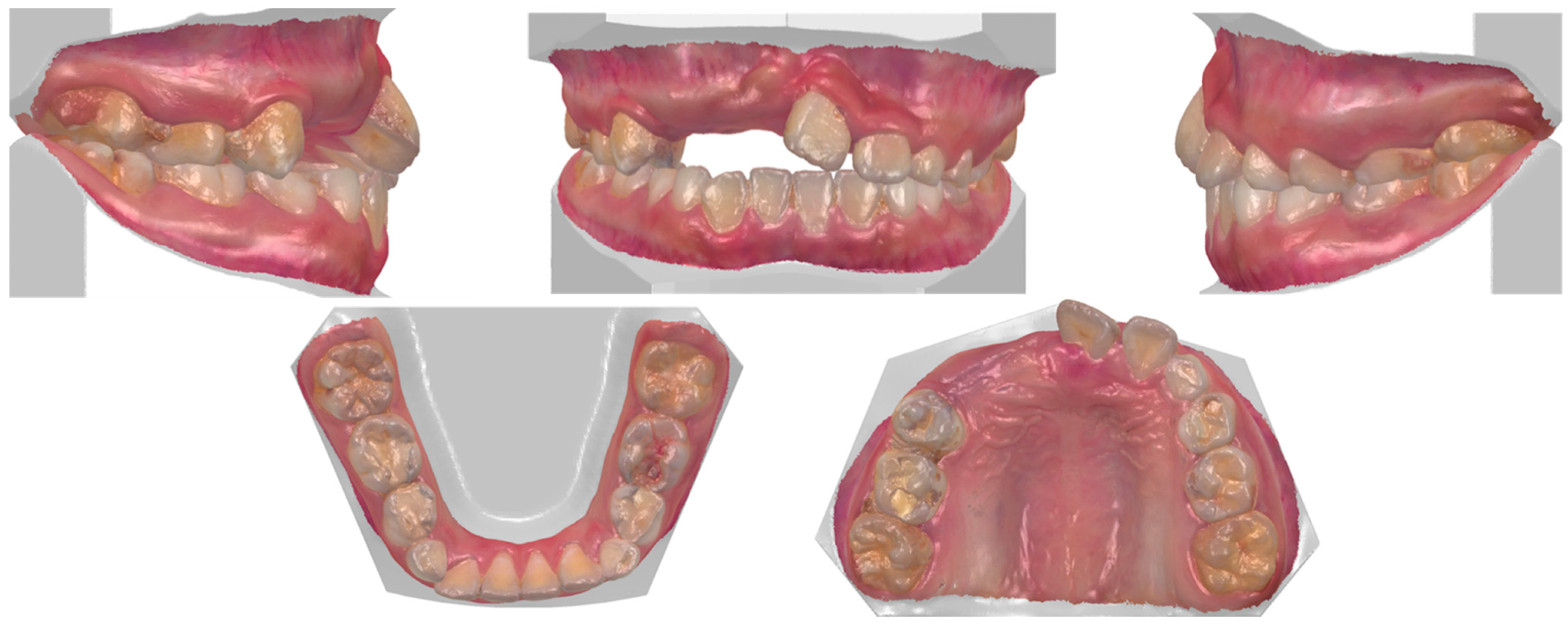 Dentistry 14 00435 g008 Dentistry 14 00435 g008