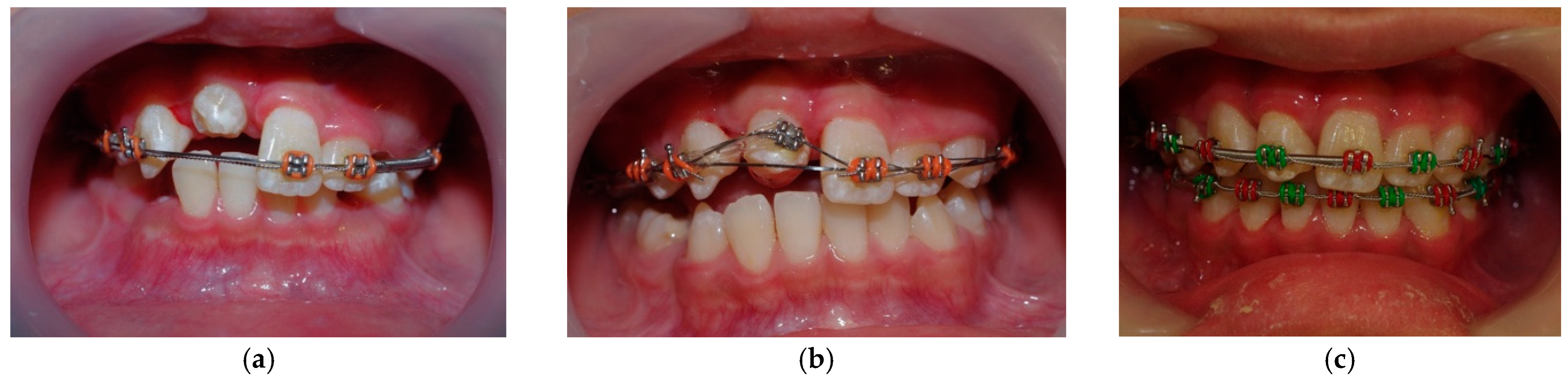 Dentistry 14 00435 g012 Dentistry 14 00435 g012