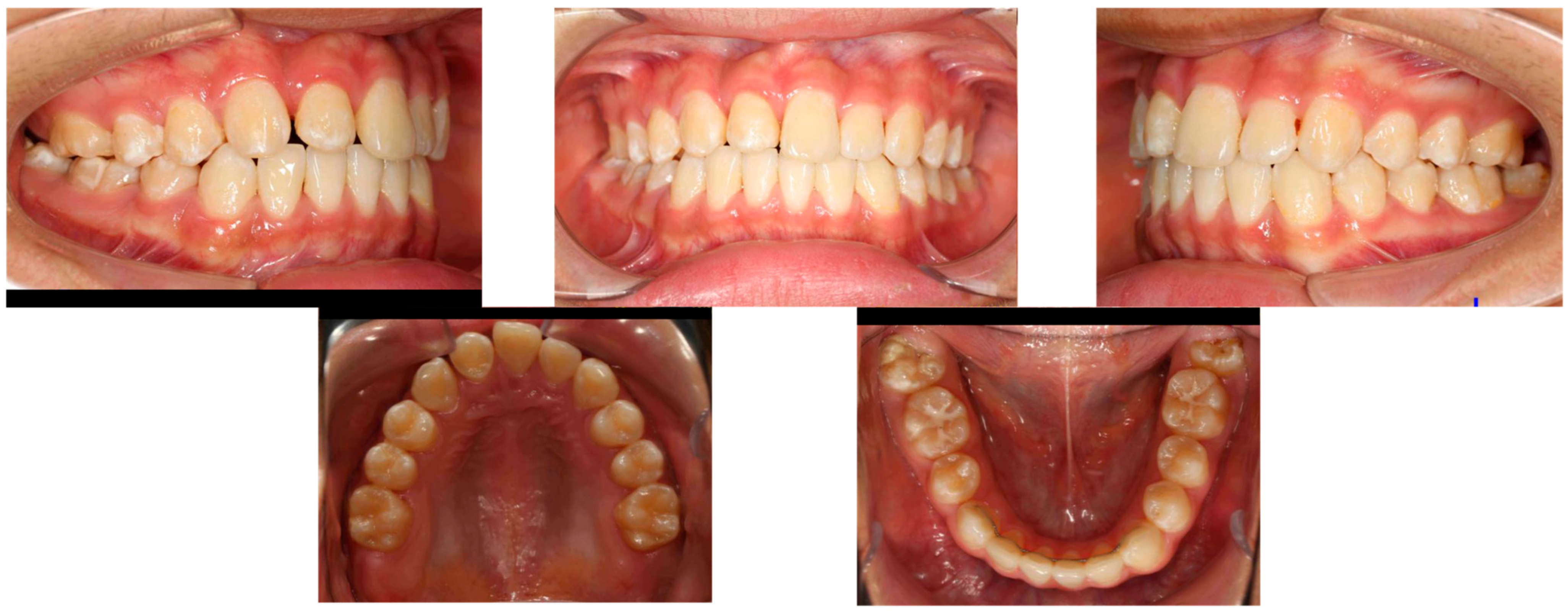 Dentistry 14 00435 g014 Dentistry 14 00435 g014