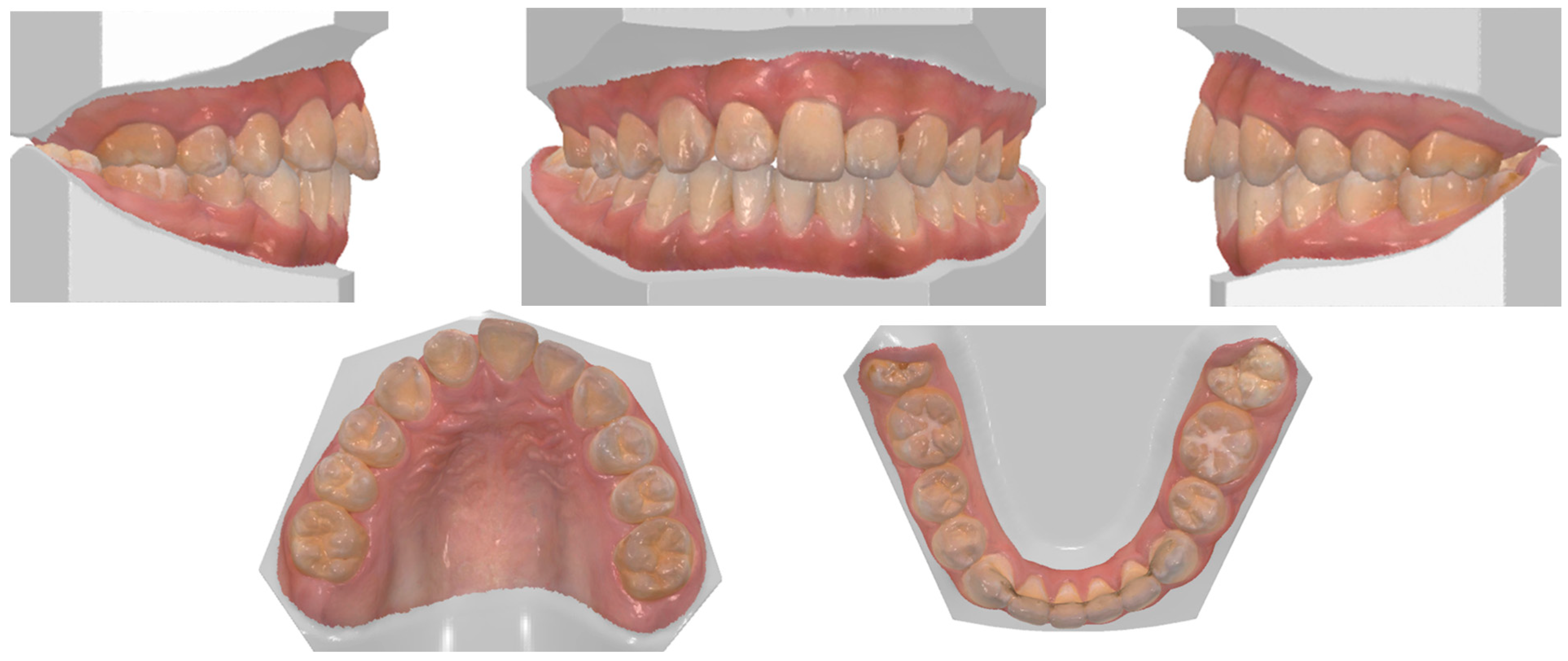 Dentistry 14 00435 g015 Dentistry 14 00435 g015