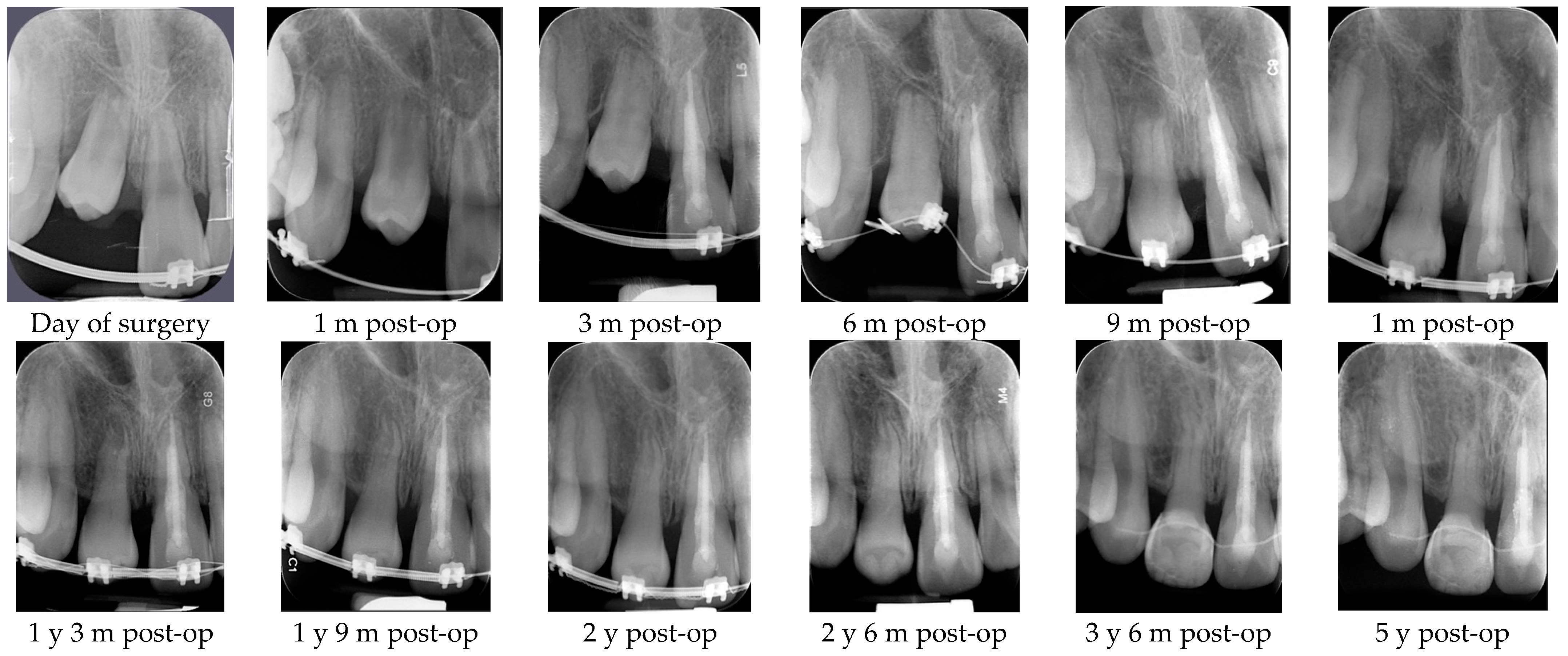 Dentistry 14 00435 g017 Dentistry 14 00435 g017