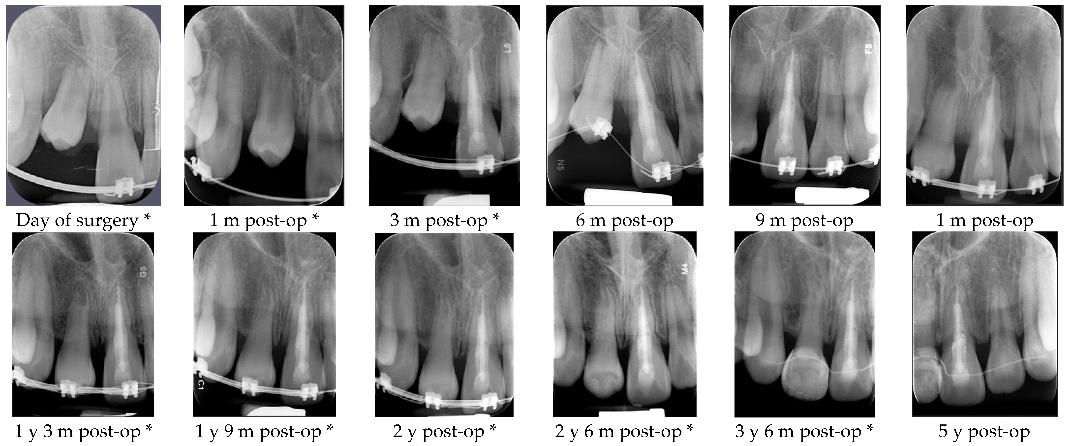 Dentistry 14 00435 g018 Dentistry 14 00435 g018