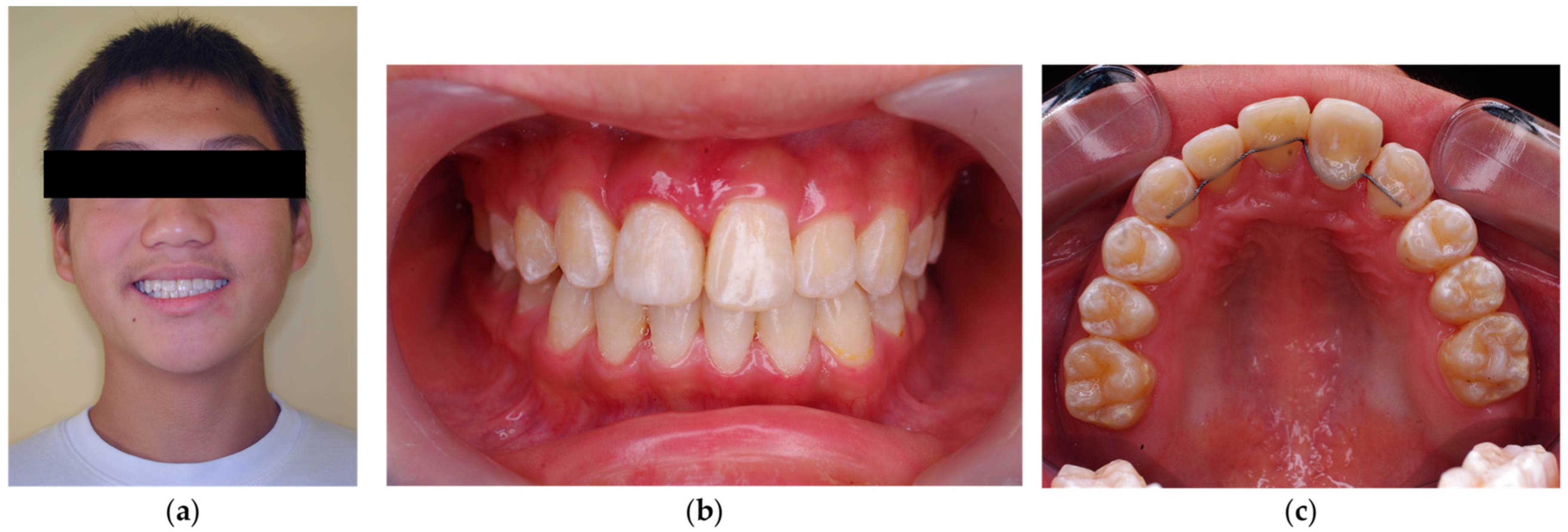 Dentistry 14 00435 g019 Dentistry 14 00435 g019