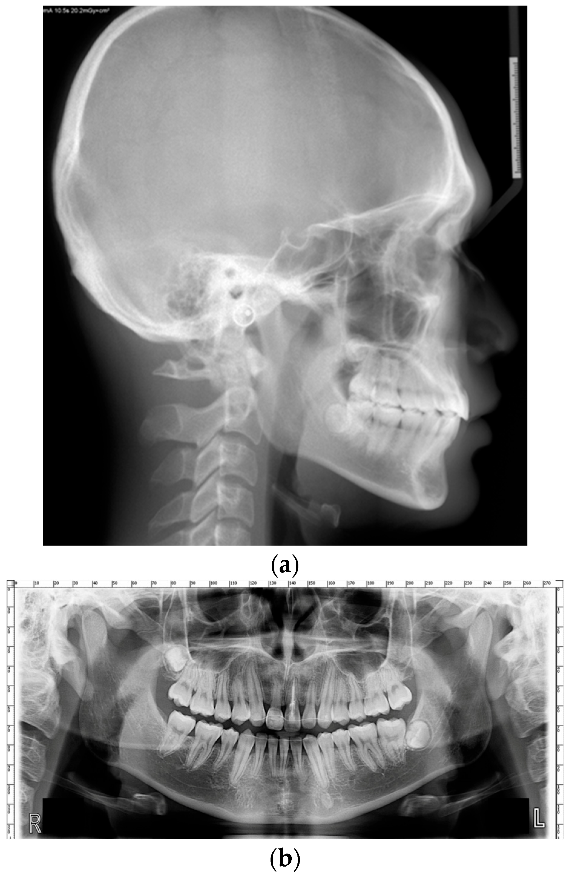 Dentistry 14 00435 g020 Dentistry 14 00435 g020