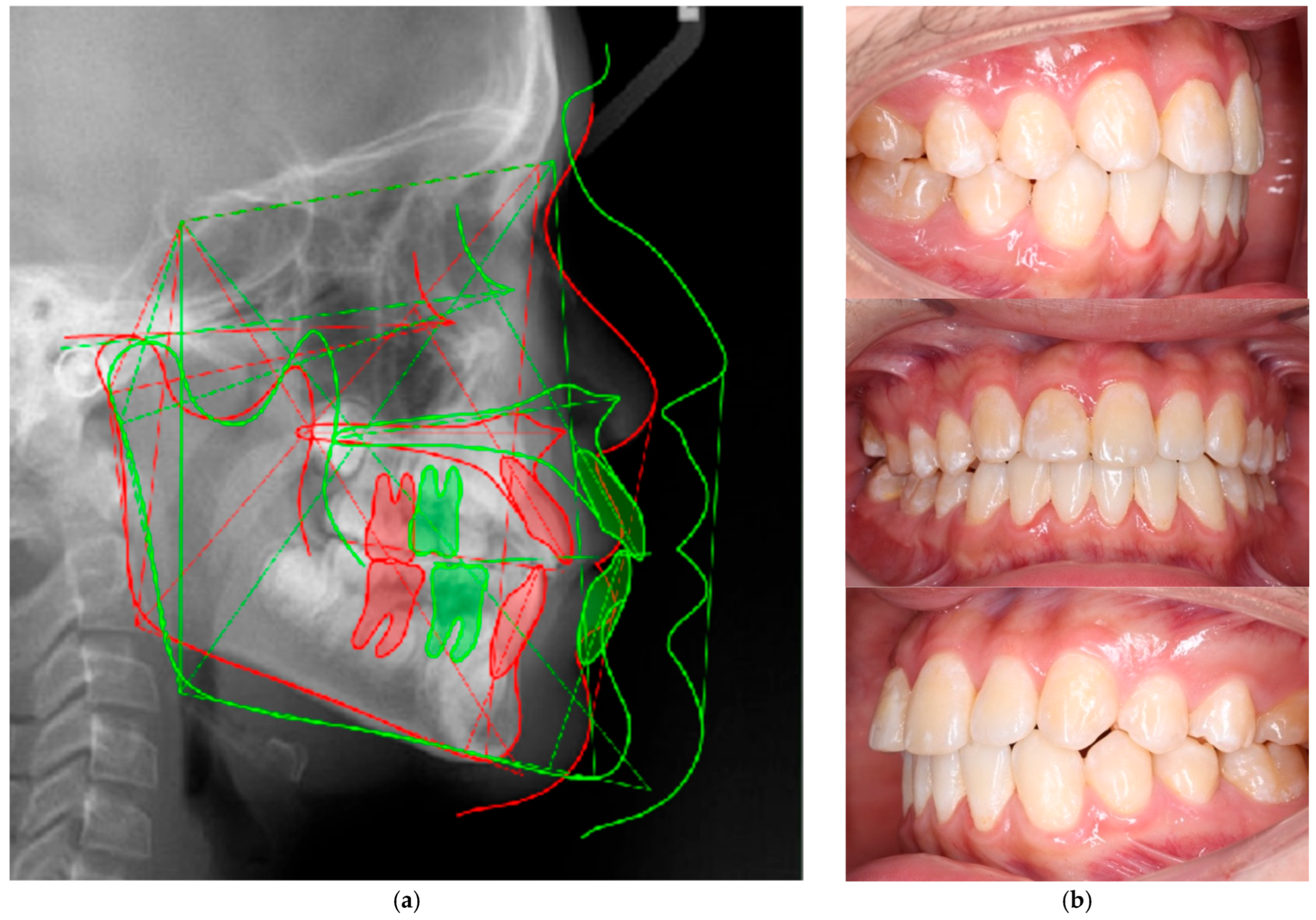 Dentistry 14 00435 g021 Dentistry 14 00435 g021