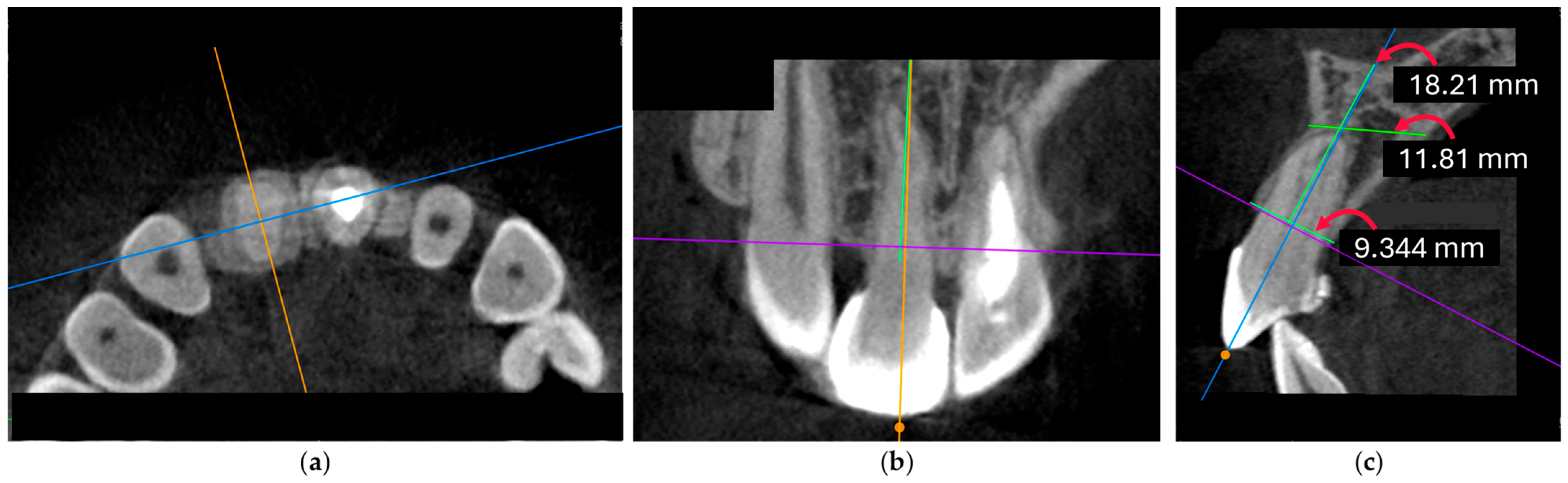 Dentistry 14 00435 g022 Dentistry 14 00435 g022