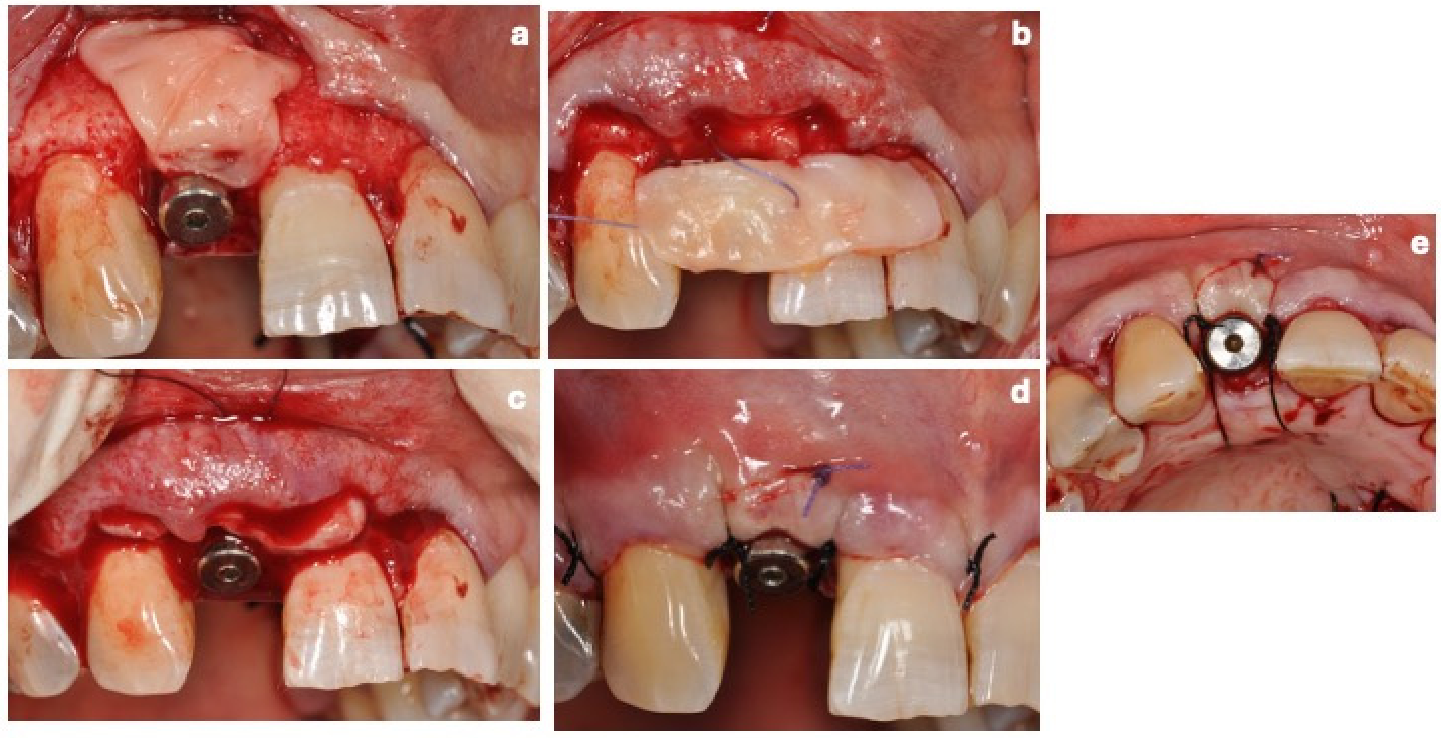 Dentistry 14 00445 g005 Dentistry 14 00445 g005