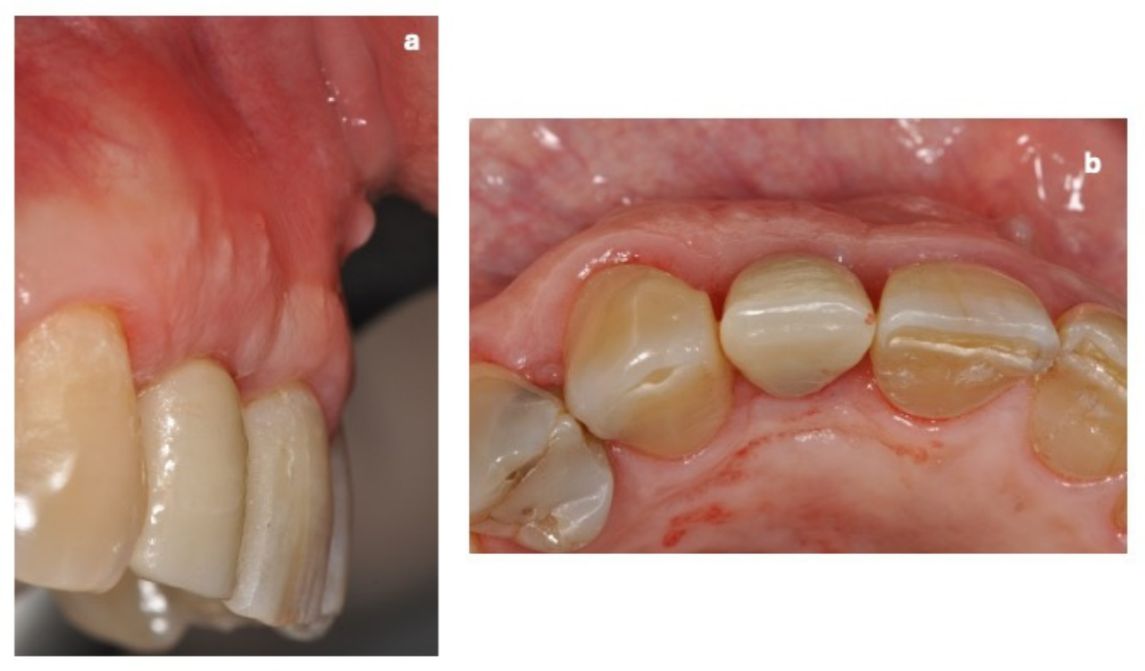 Dentistry 14 00445 g008 Dentistry 14 00445 g008