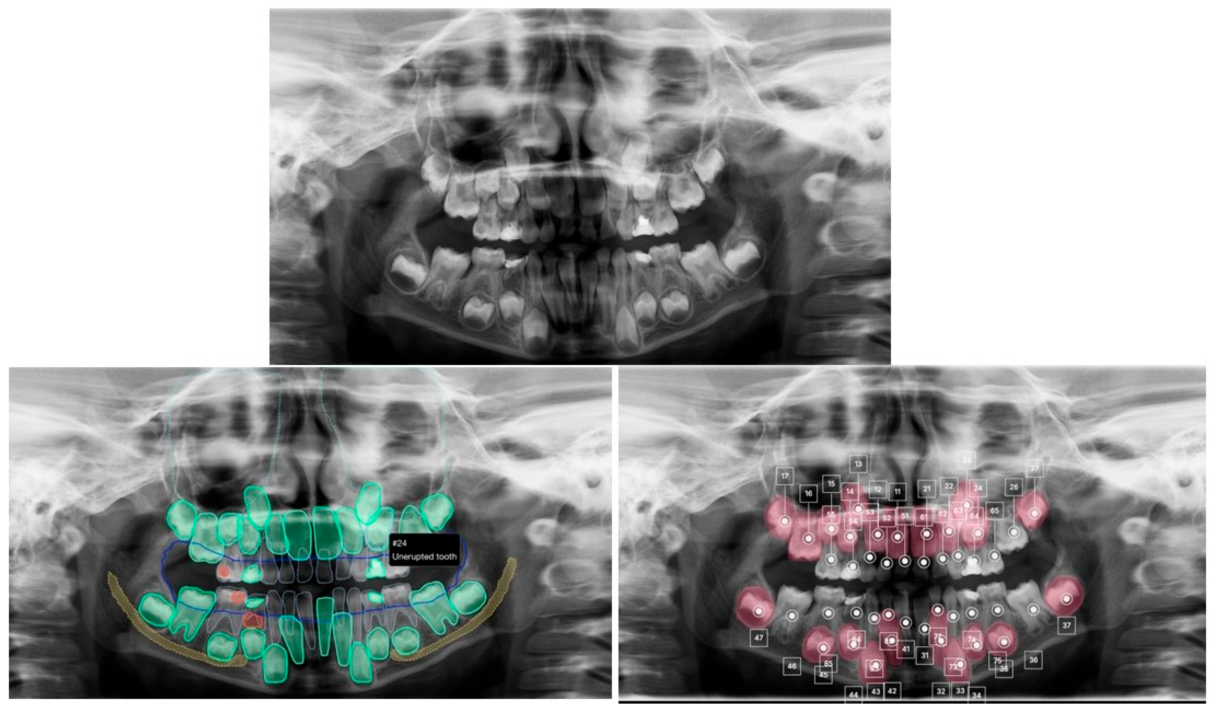 Dentistry 14 00569 g003 Dentistry 14 00569 g003