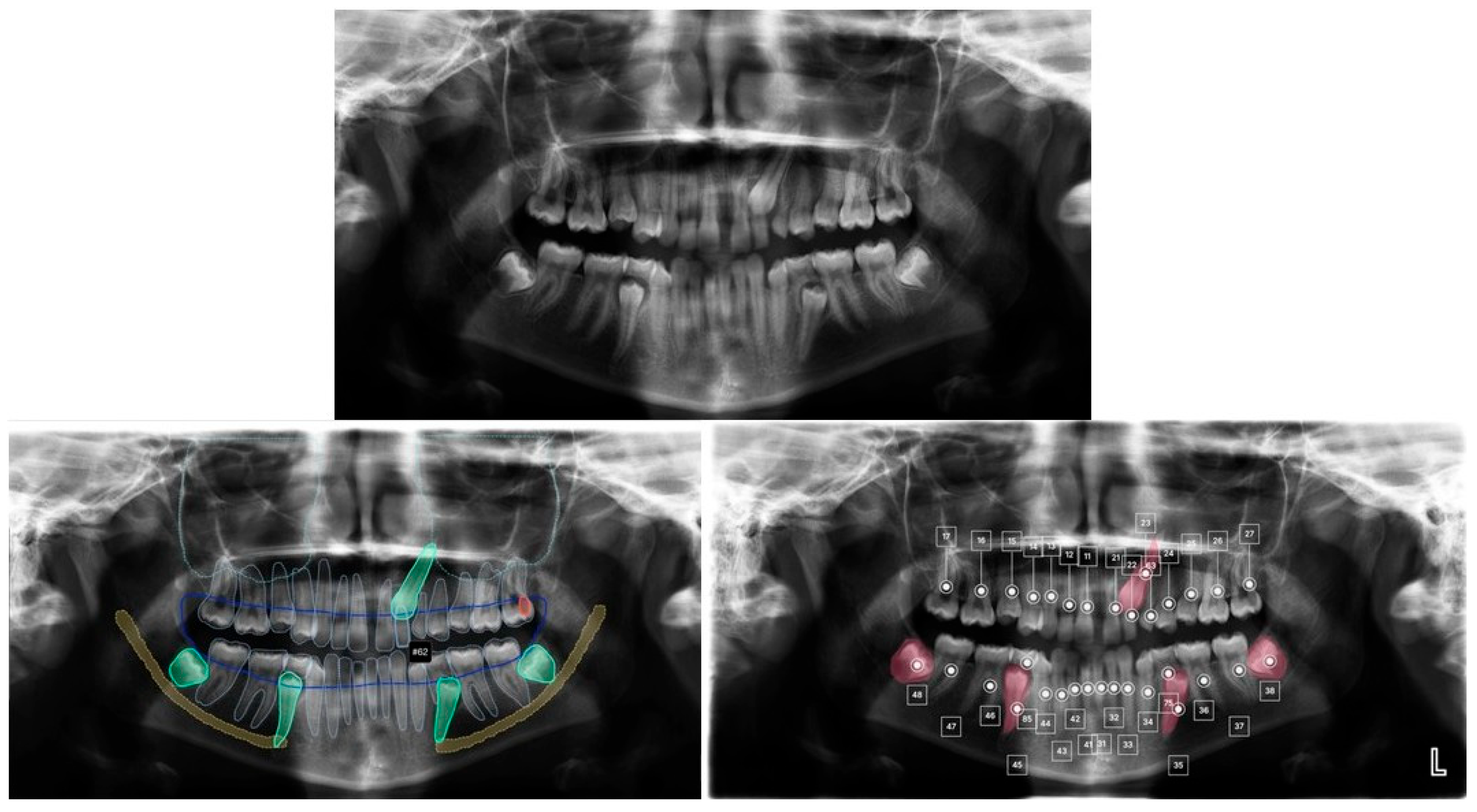 Dentistry 14 00569 g004 Dentistry 14 00569 g004