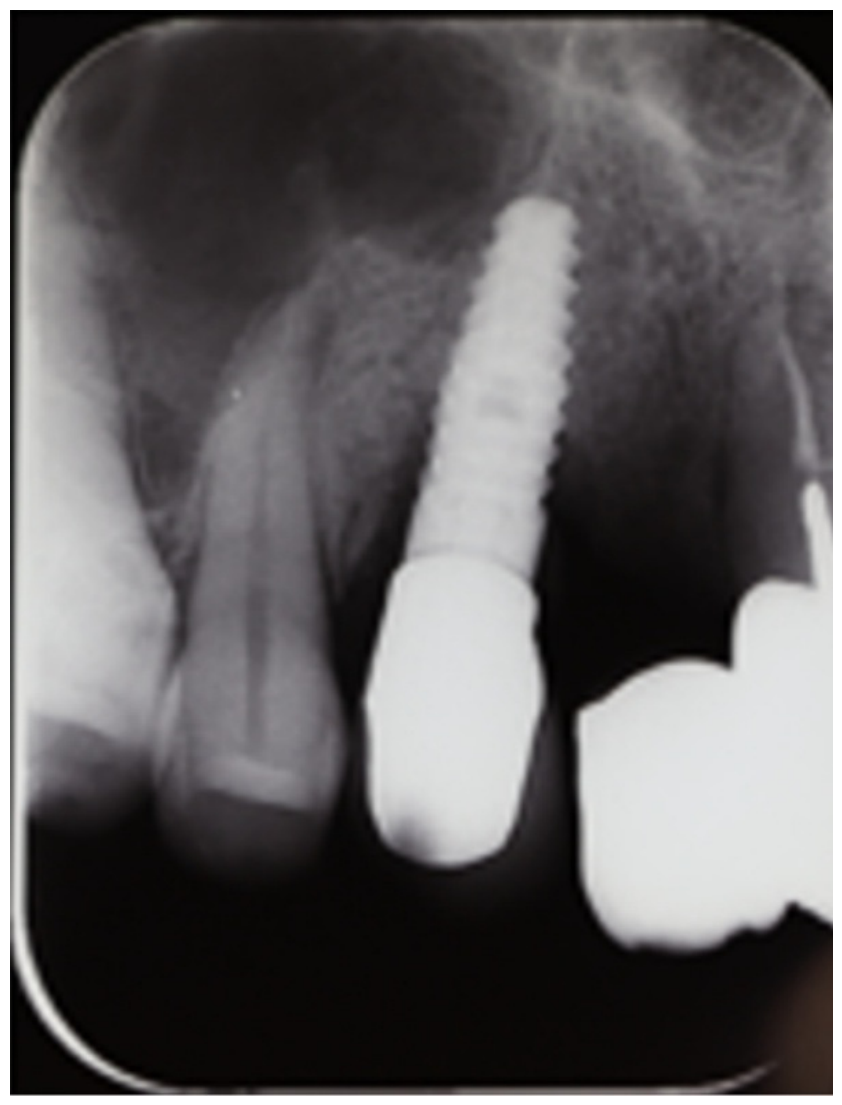 Dentistry 14 00600 g002