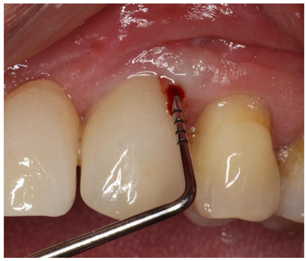Dentistry 14 00600 g003