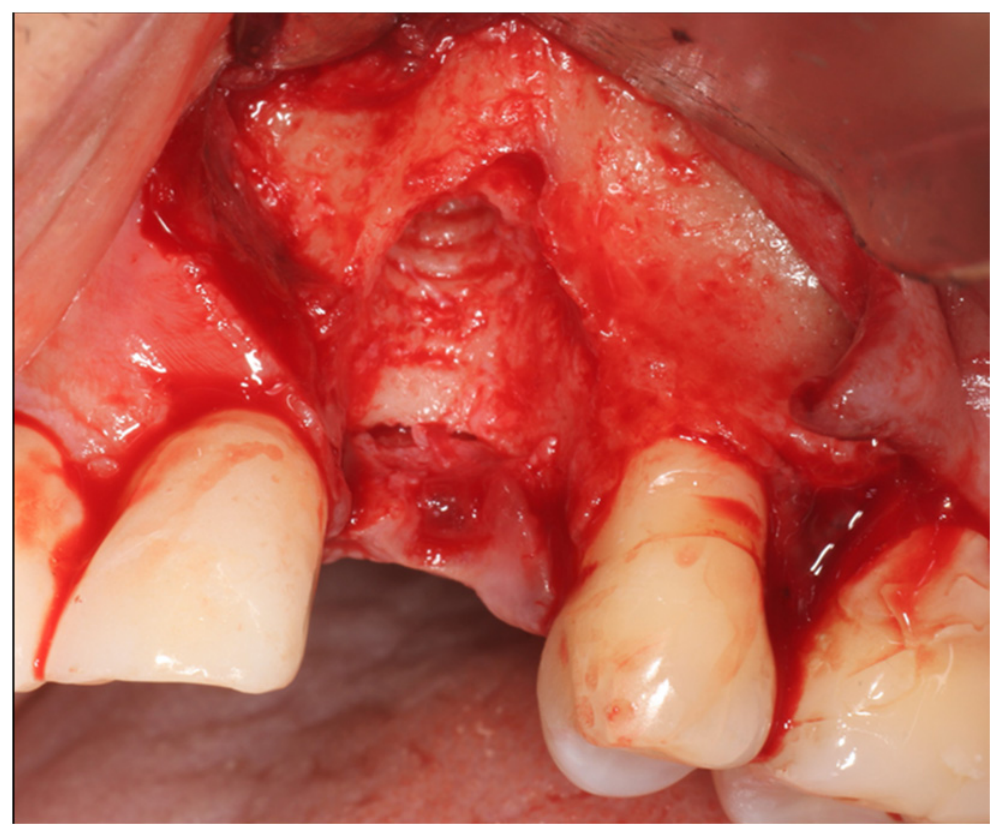 Dentistry 14 00600 g004
