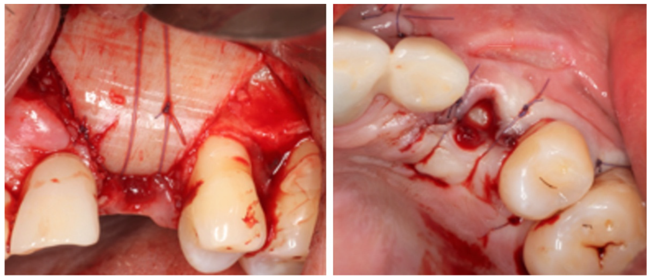 Dentistry 14 00600 g005