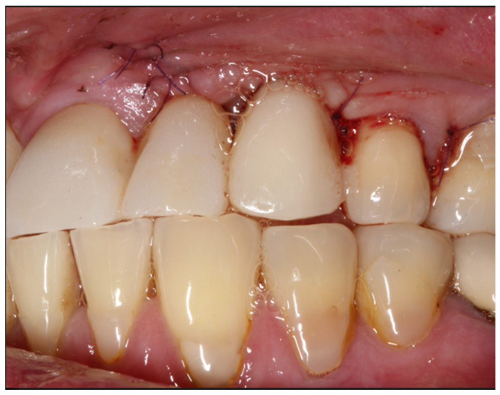 Dentistry 14 00600 g006