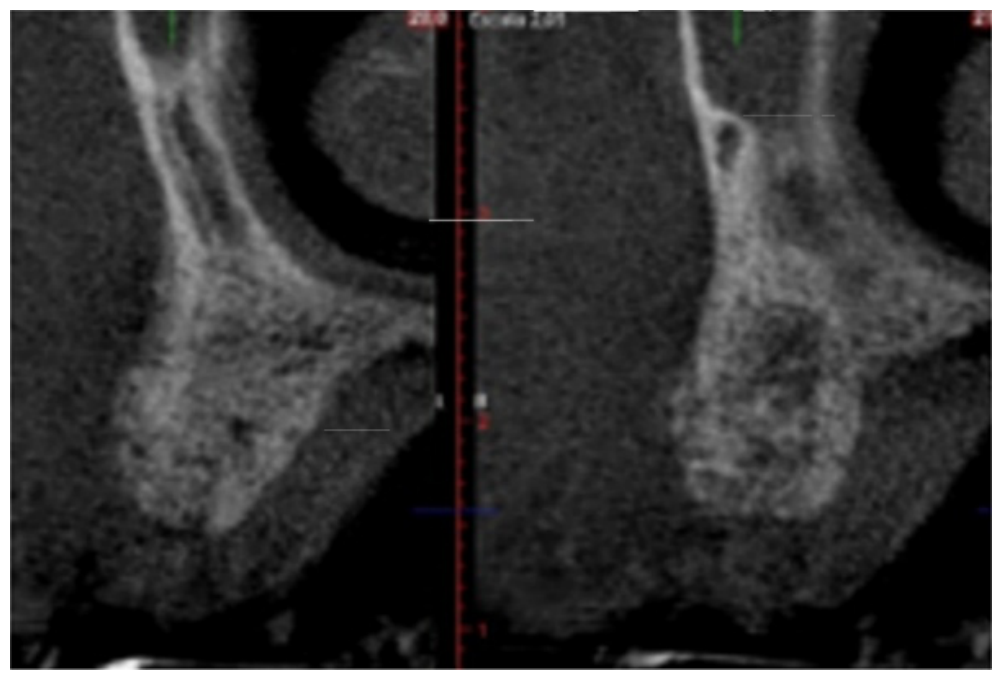 Dentistry 14 00600 g007