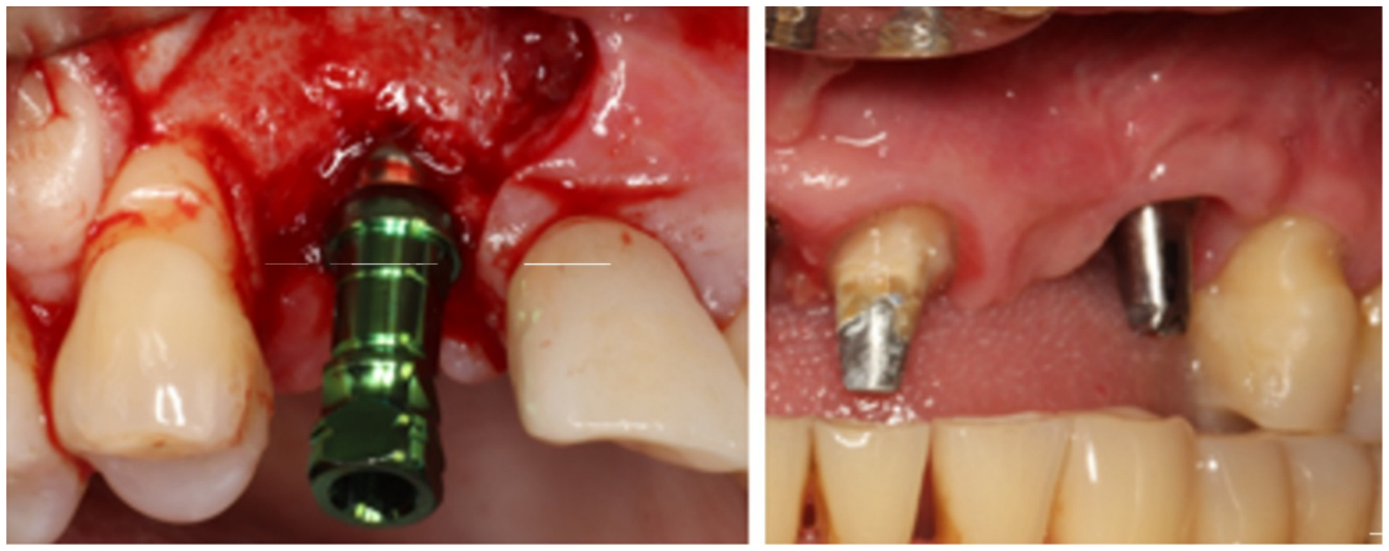 Dentistry 14 00600 g008