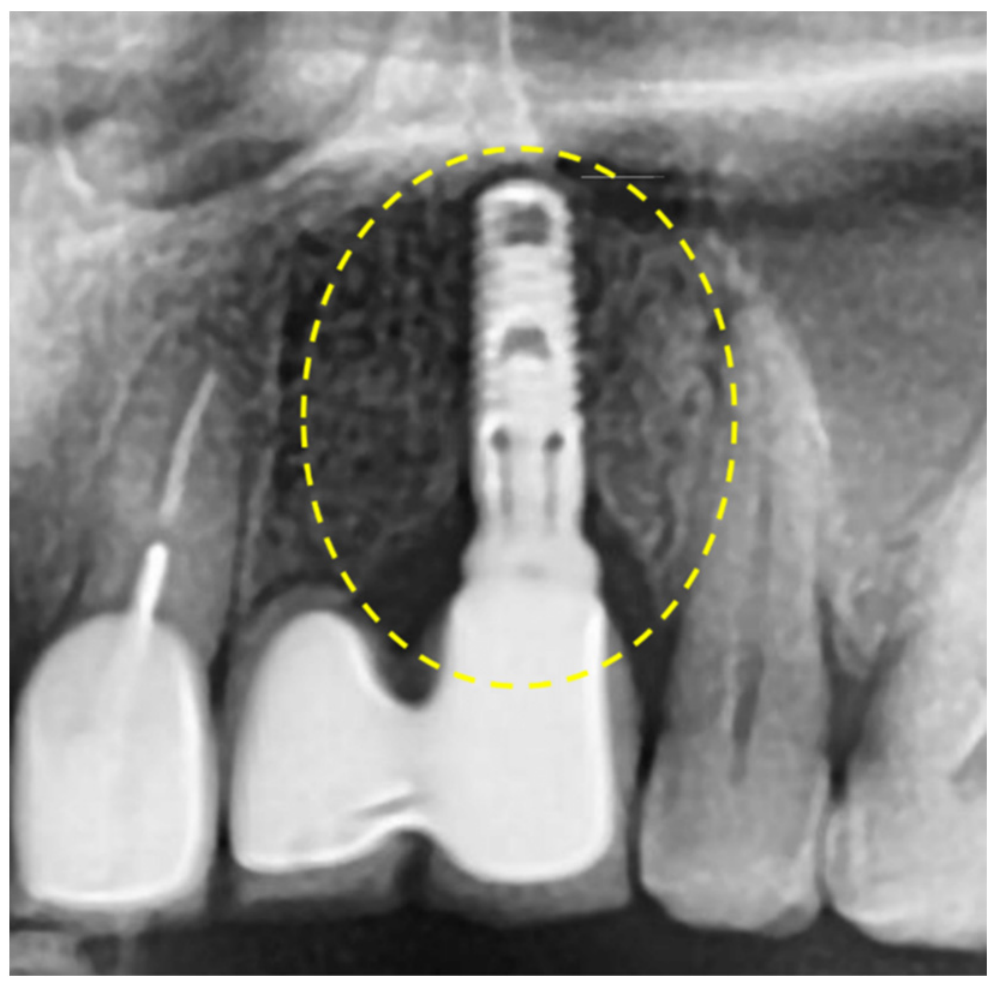 Dentistry 14 00600 g009