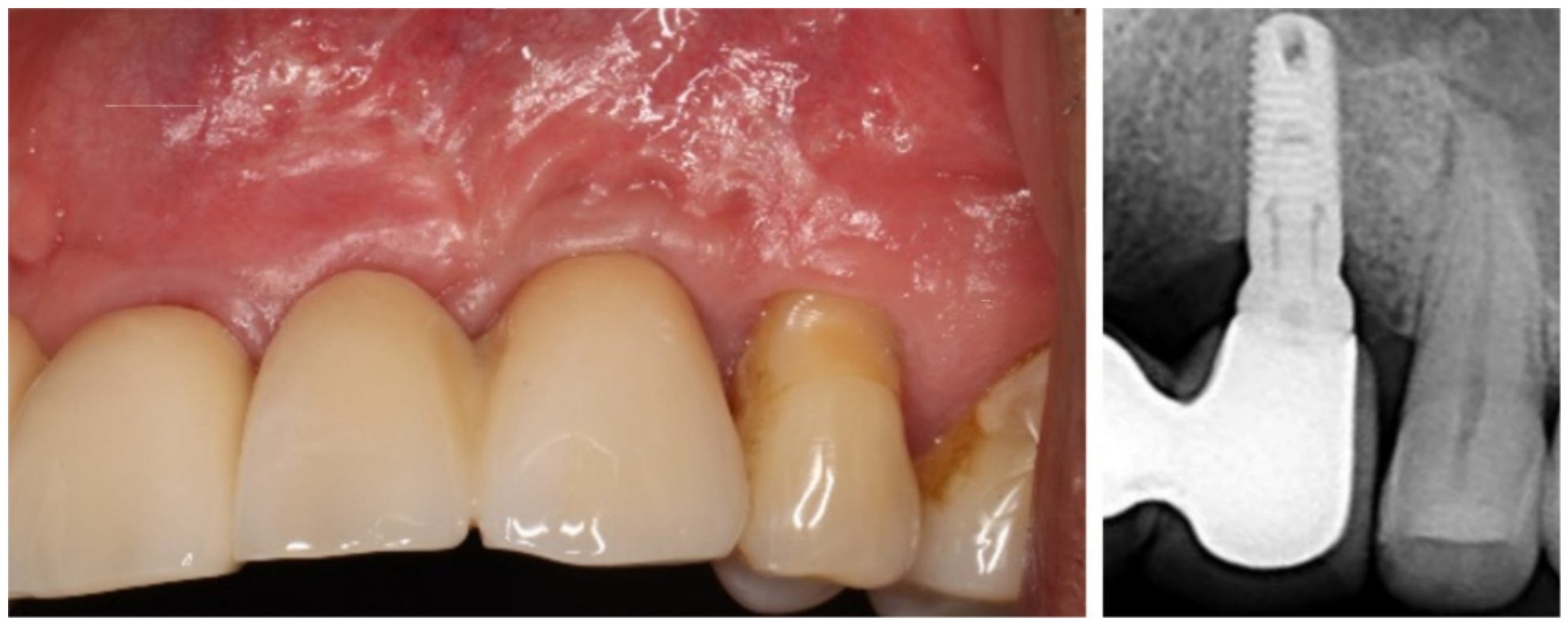 Dentistry 14 00600 g010