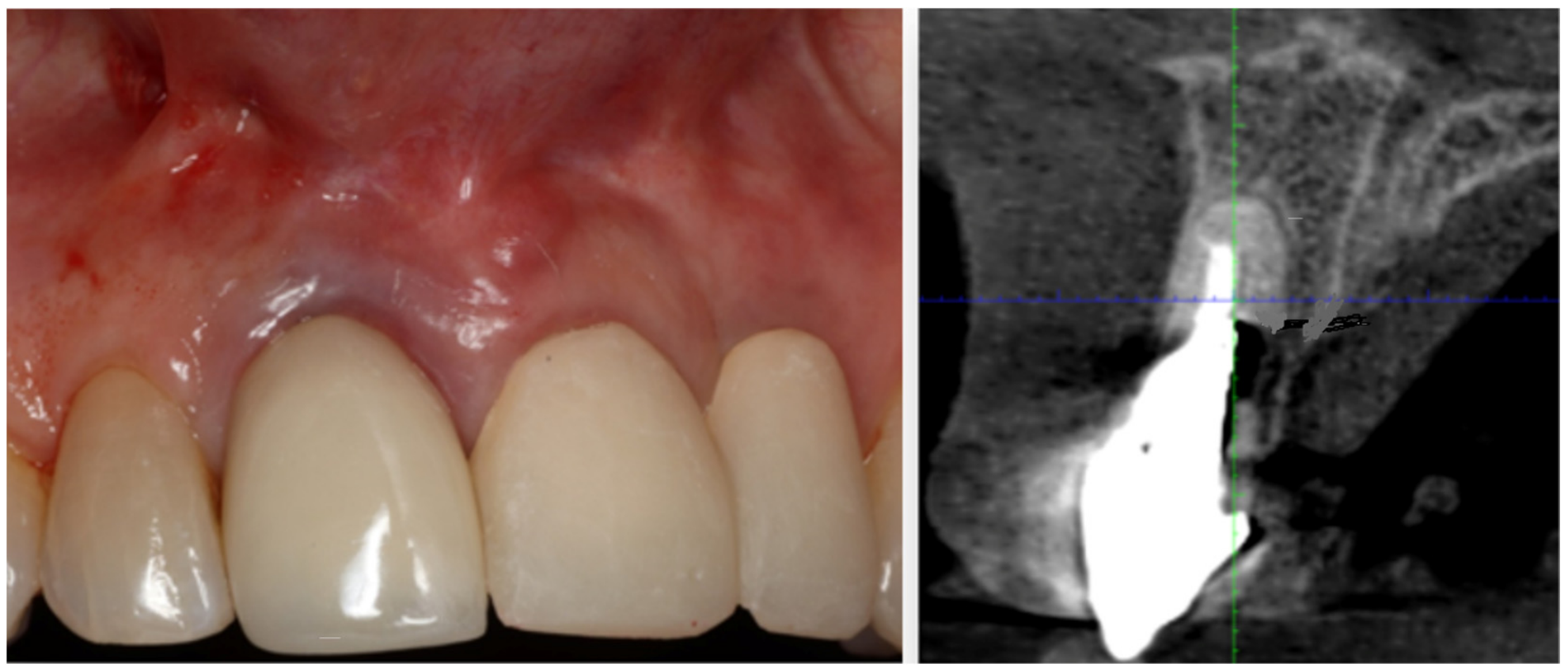 Dentistry 14 00600 g011