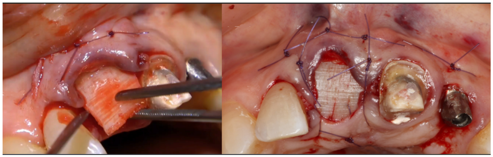 Dentistry 14 00600 g013