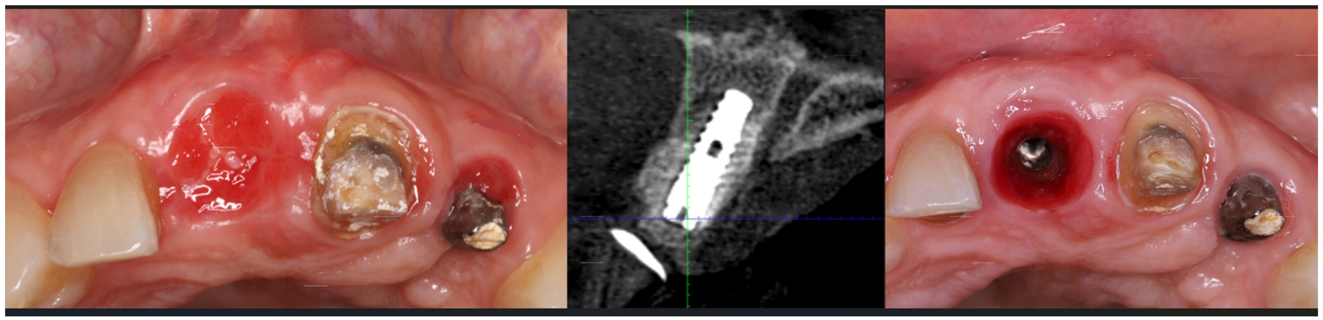 Dentistry 14 00600 g014