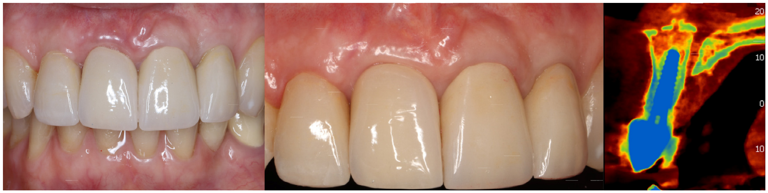 Dentistry 14 00600 g015