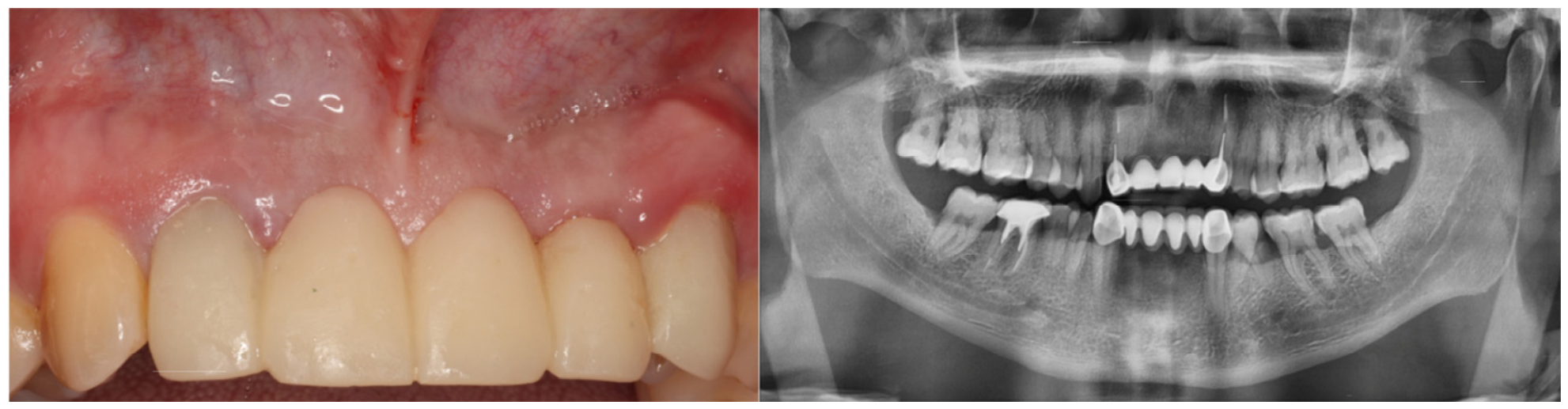 Dentistry 14 00600 g016