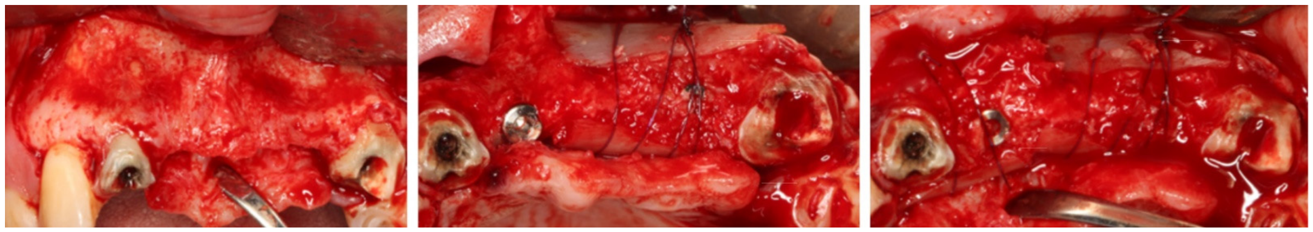 Dentistry 14 00600 g017