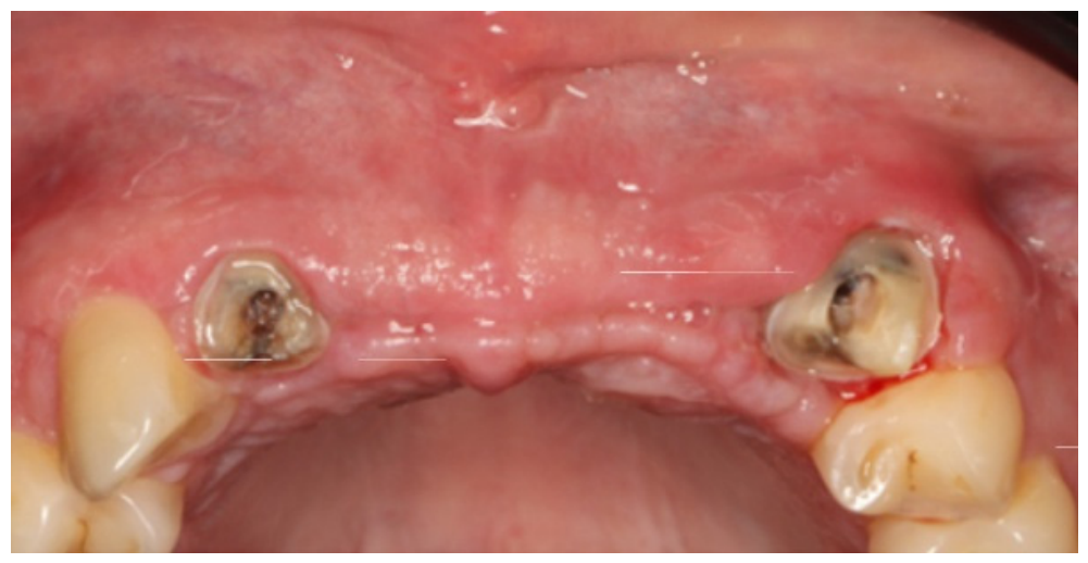 Dentistry 14 00600 g018