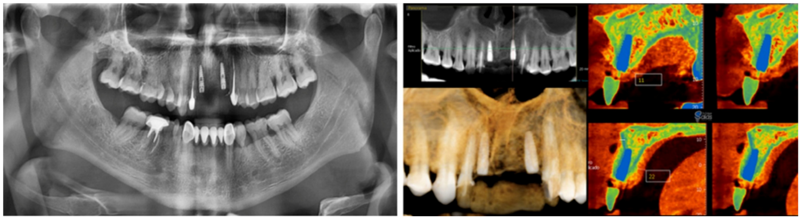 Dentistry 14 00600 g019