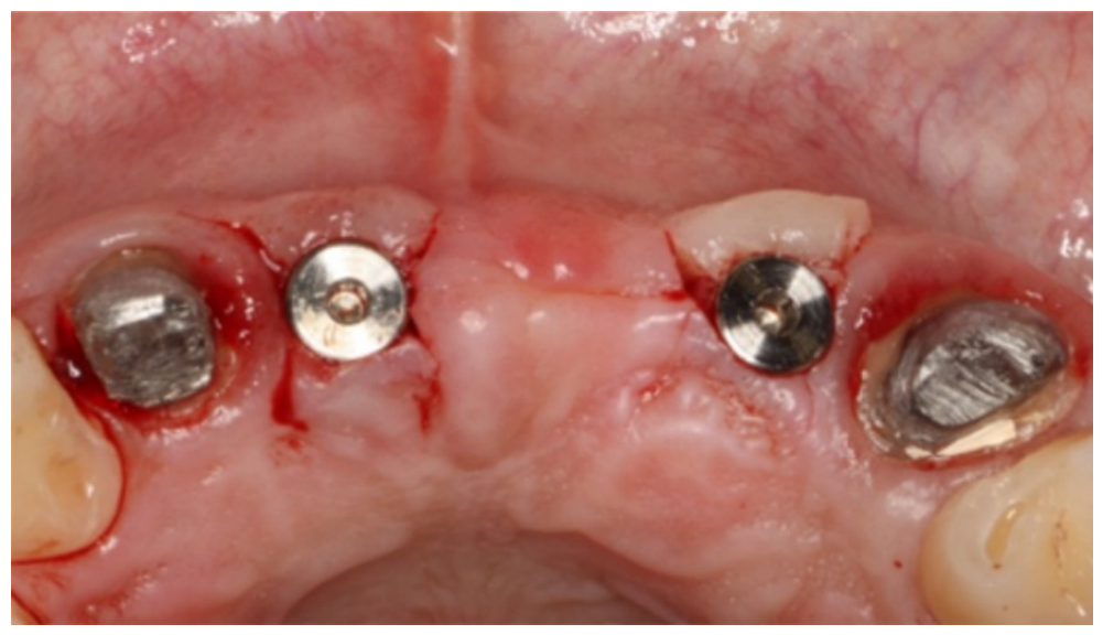 Dentistry 14 00600 g020