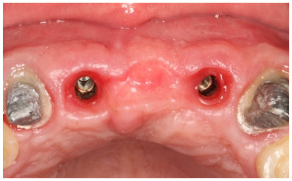 Dentistry 14 00600 g021