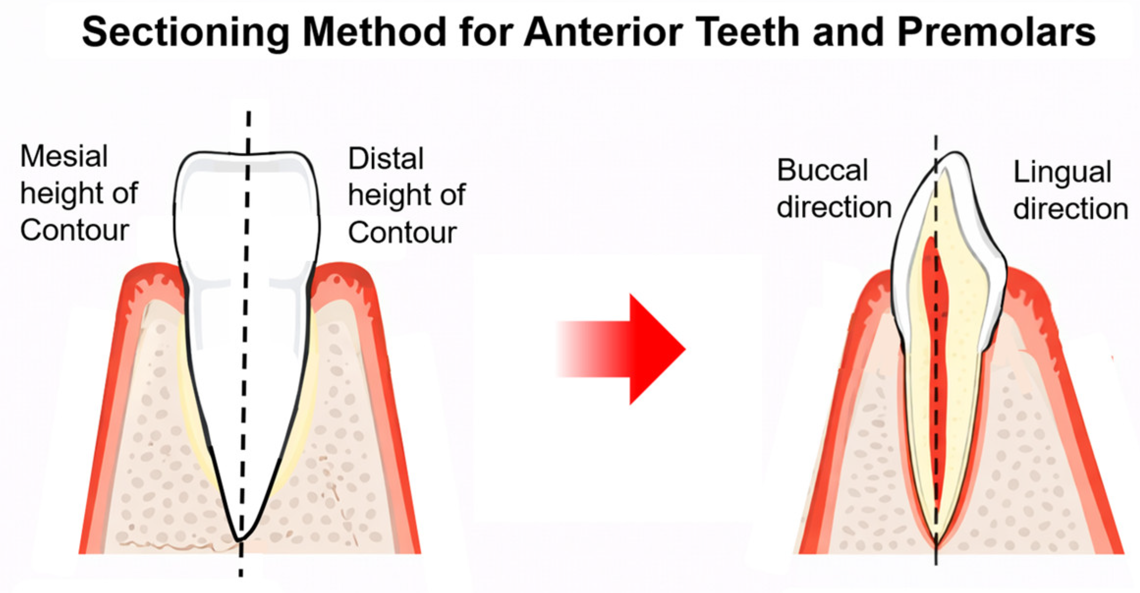 Dentistry 14 00670 g001 Dentistry 14 00670 g001