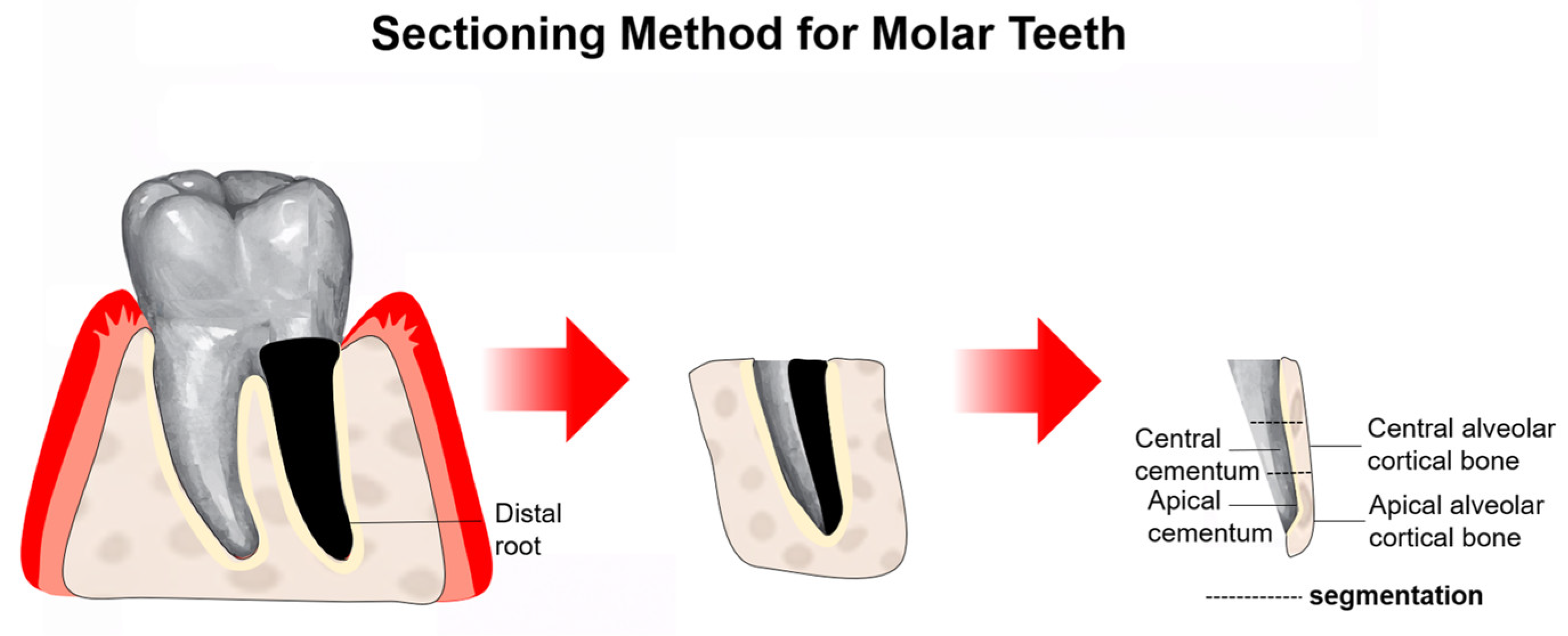 Dentistry 14 00670 g002 Dentistry 14 00670 g002