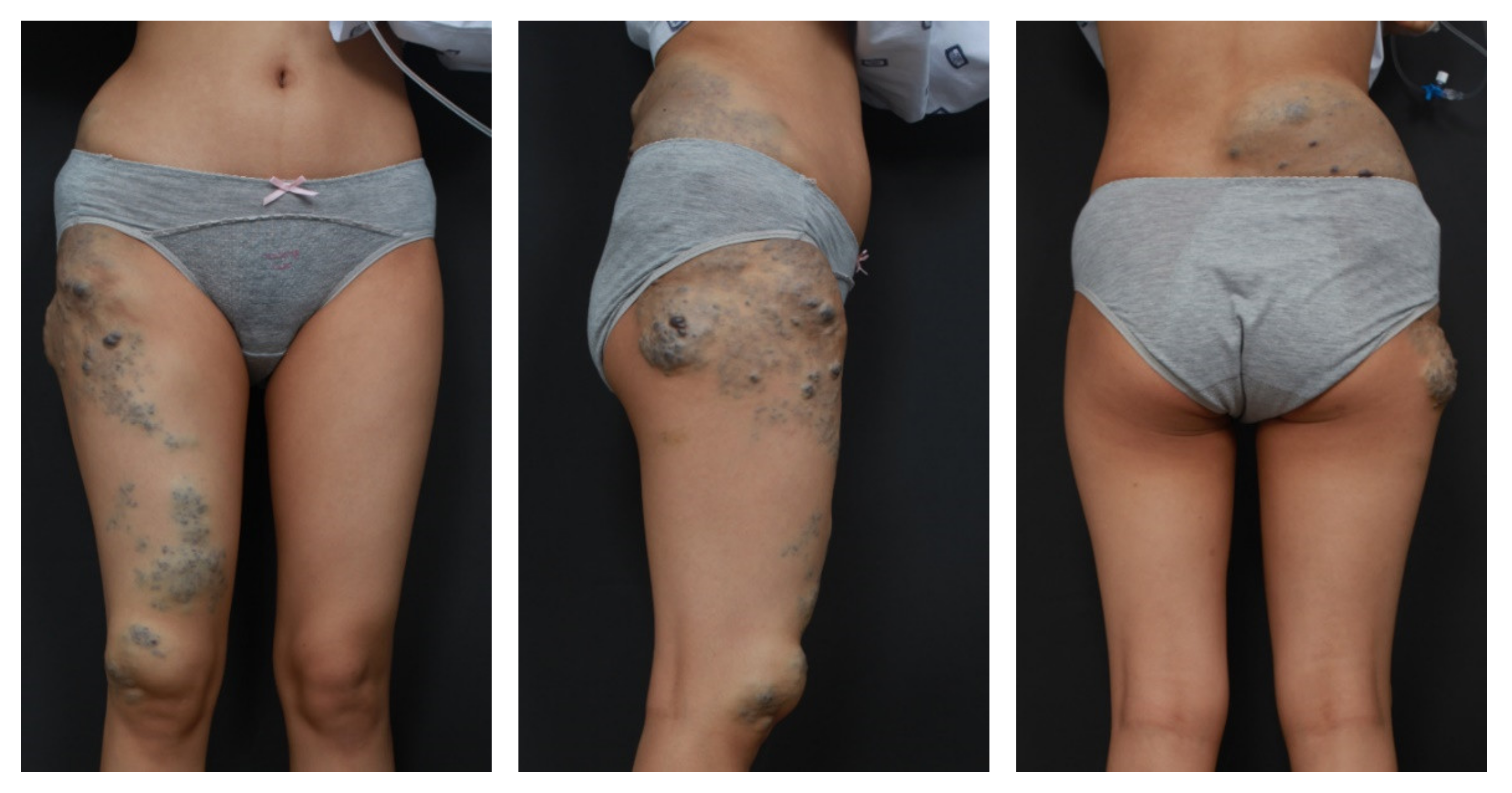 Dermato 01 00007 g001