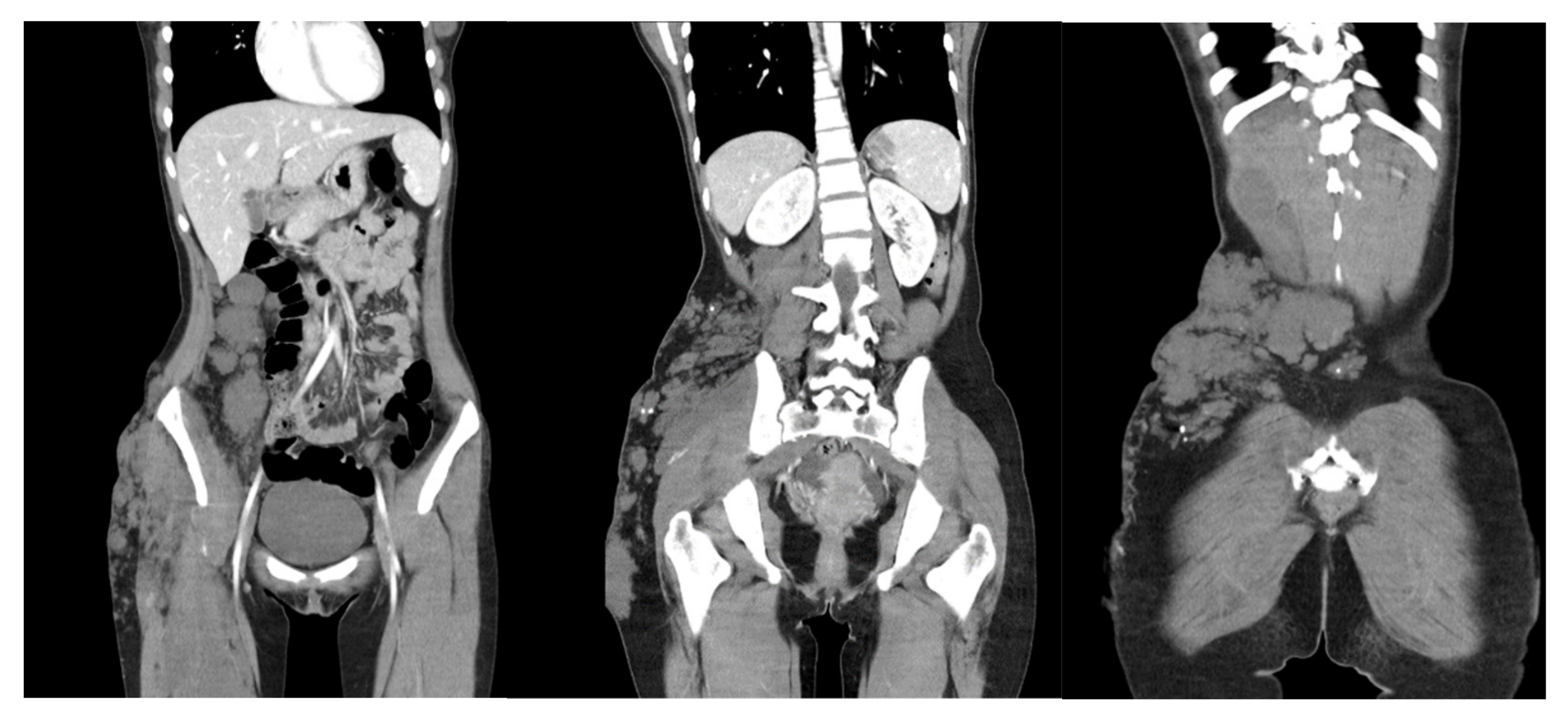 Dermato 01 00007 g002
