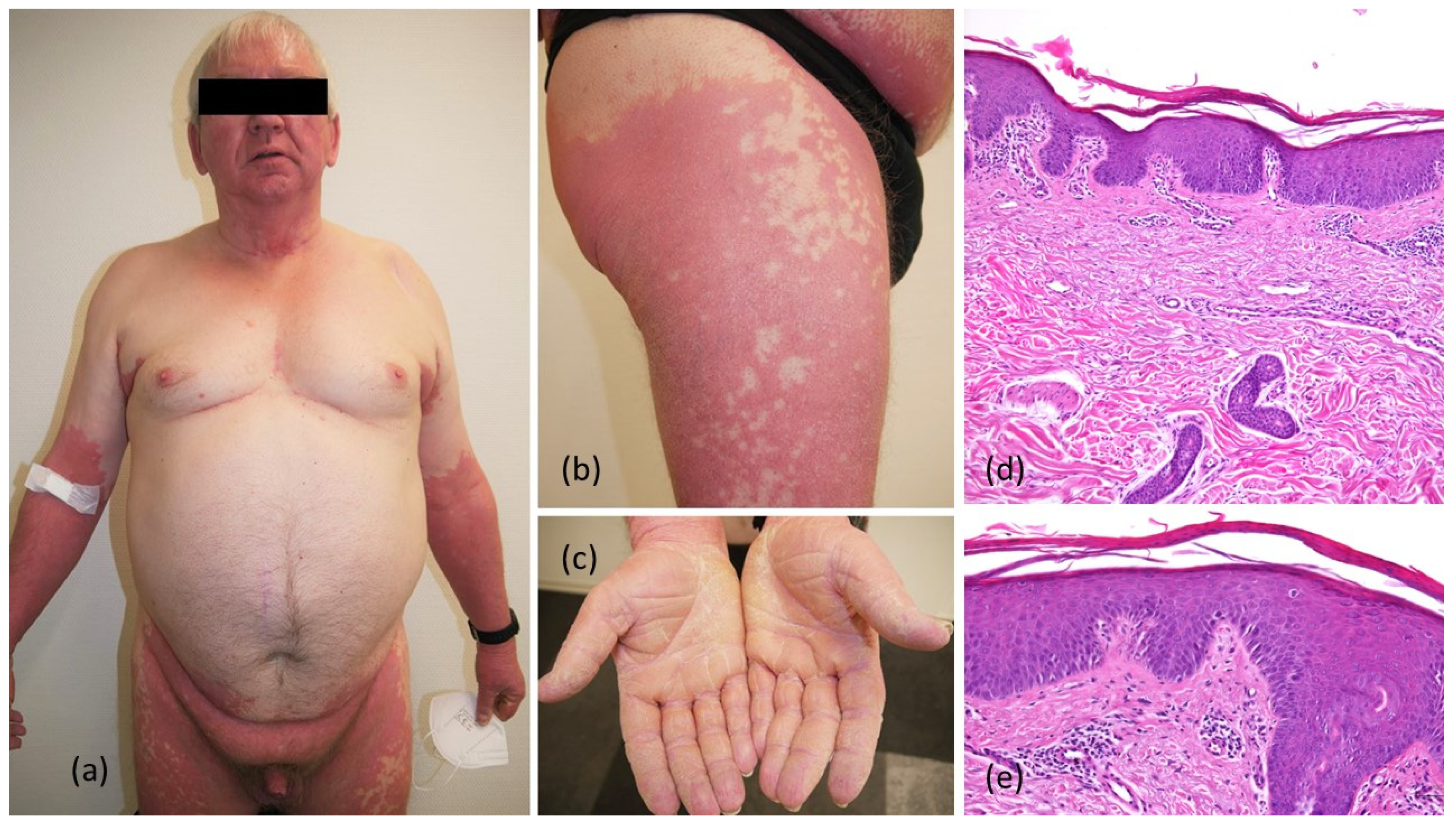 Dermato 02 00008 g001