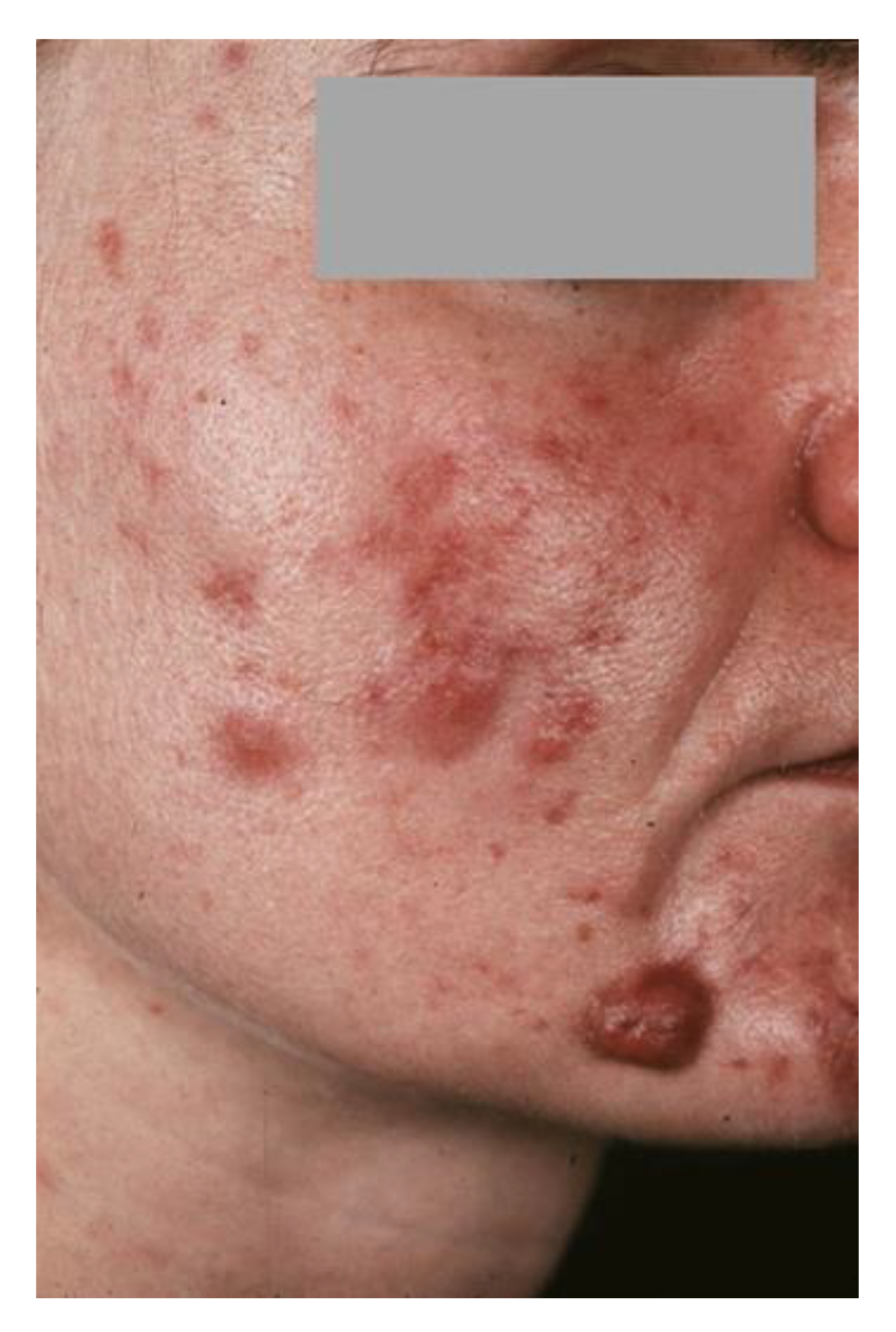 Dermato 02 00010 g001 Dermato 02 00010 g001