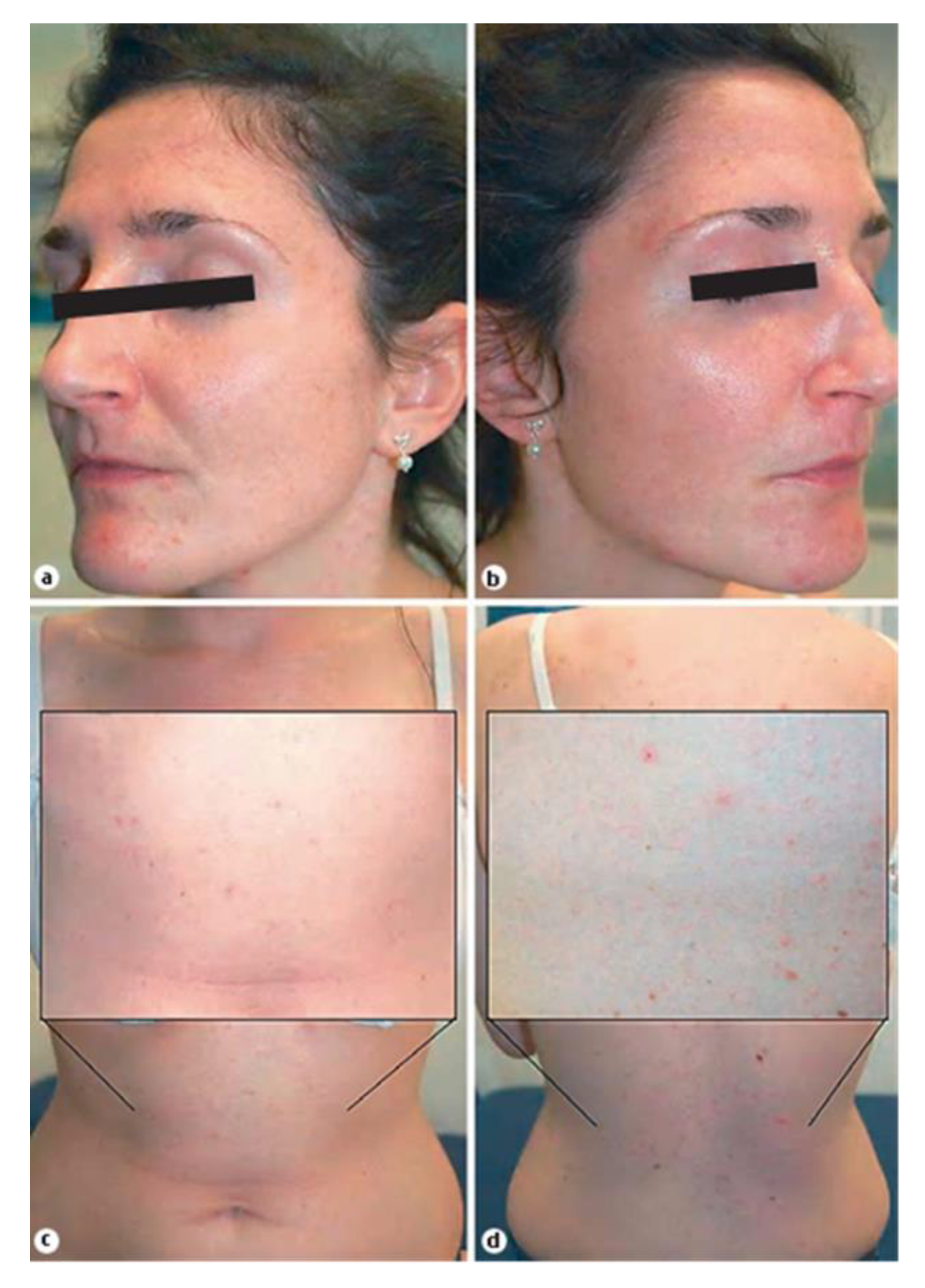 Dermato 02 00010 g002 Dermato 02 00010 g002