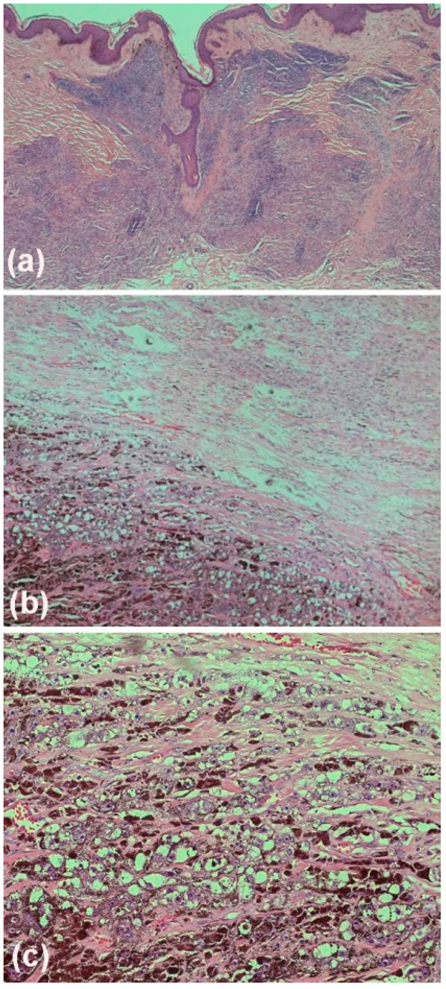Dermato 03 00004 g003
