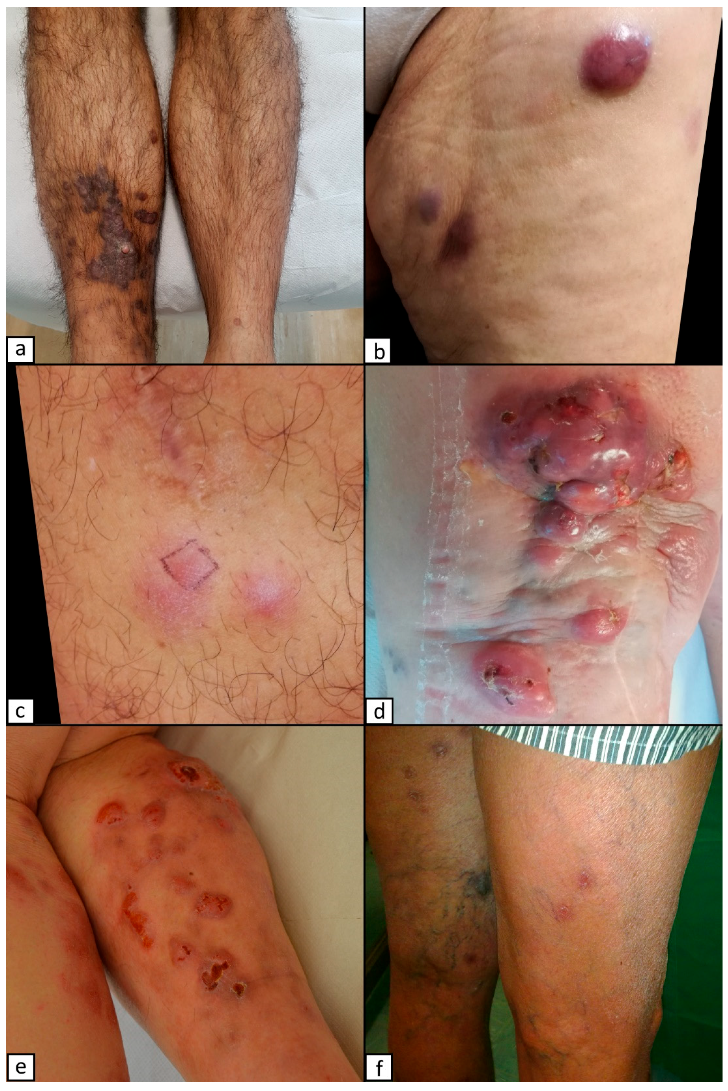 Dermato 03 00005 g001 Dermato 03 00005 g001