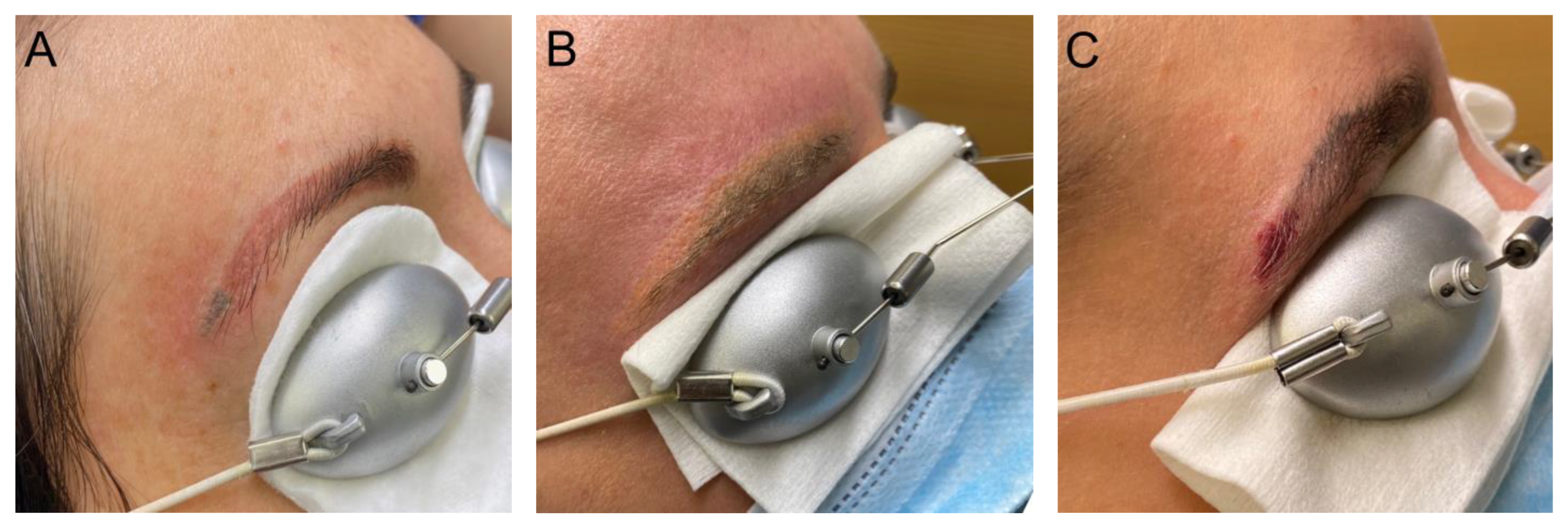 Dermato 03 00014 g003