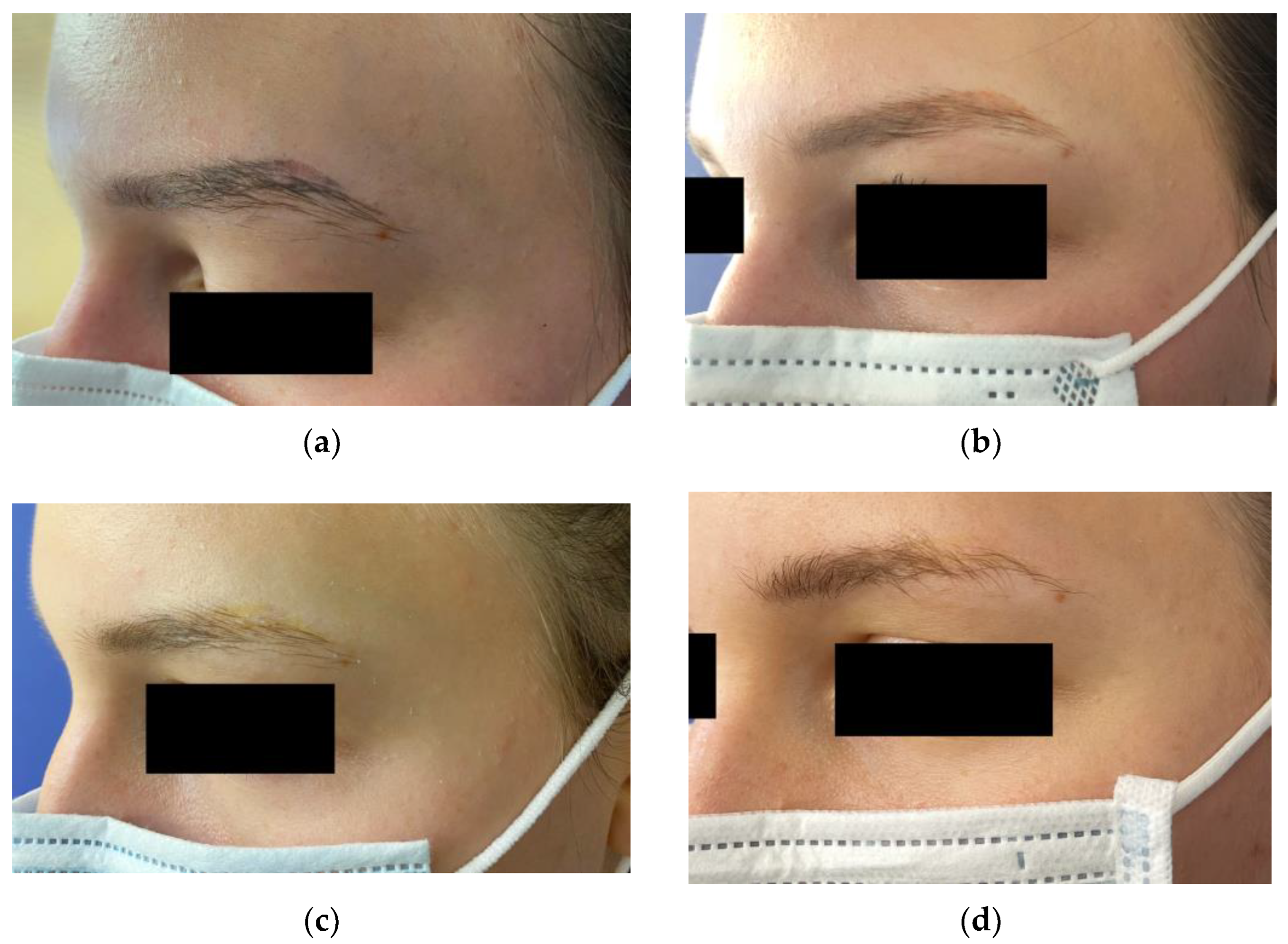 Dermato 03 00014 g005