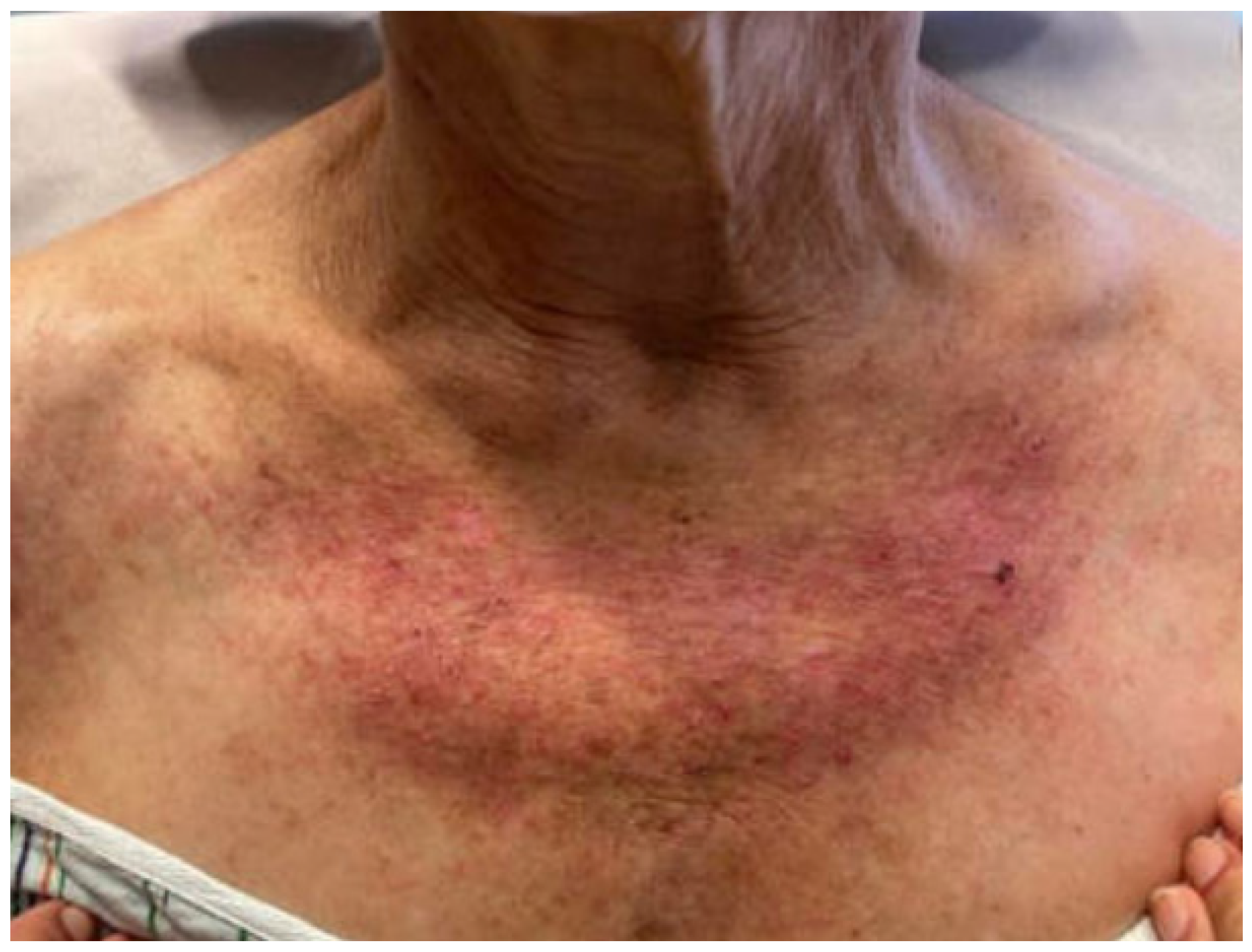 Dermato 03 00018 g001