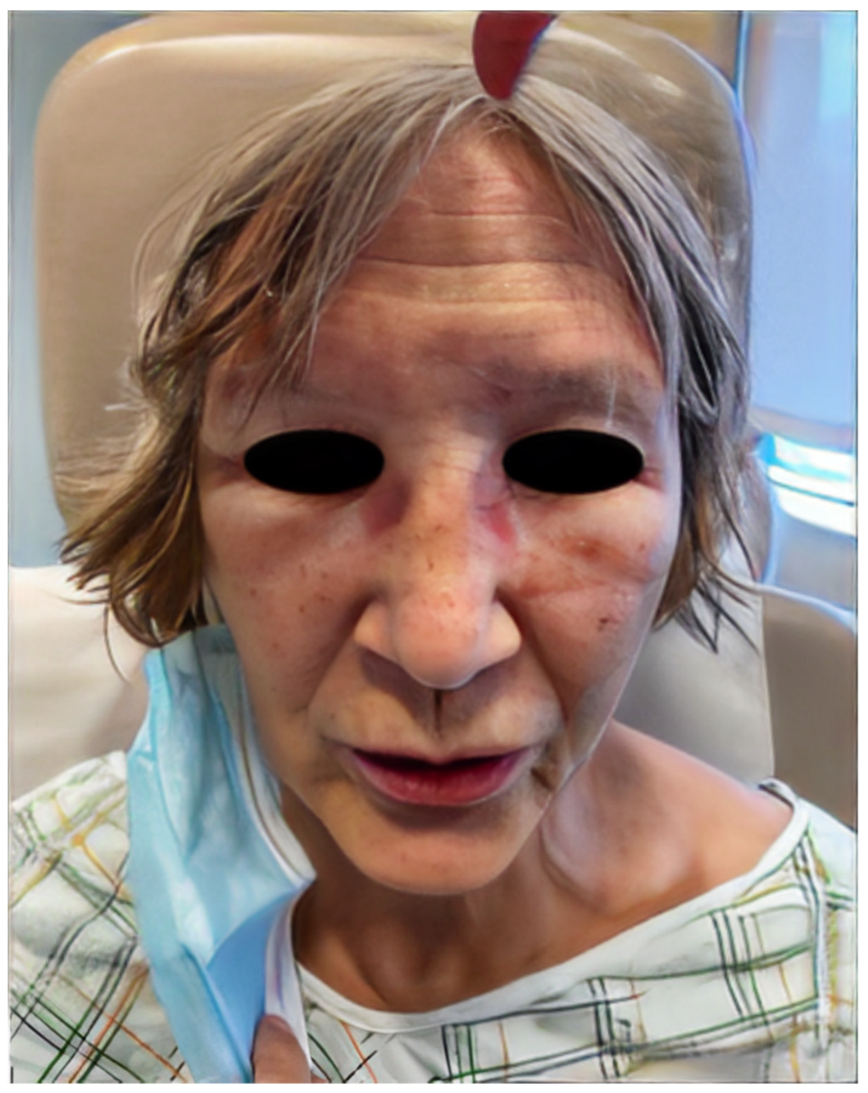 Dermato 03 00018 g002