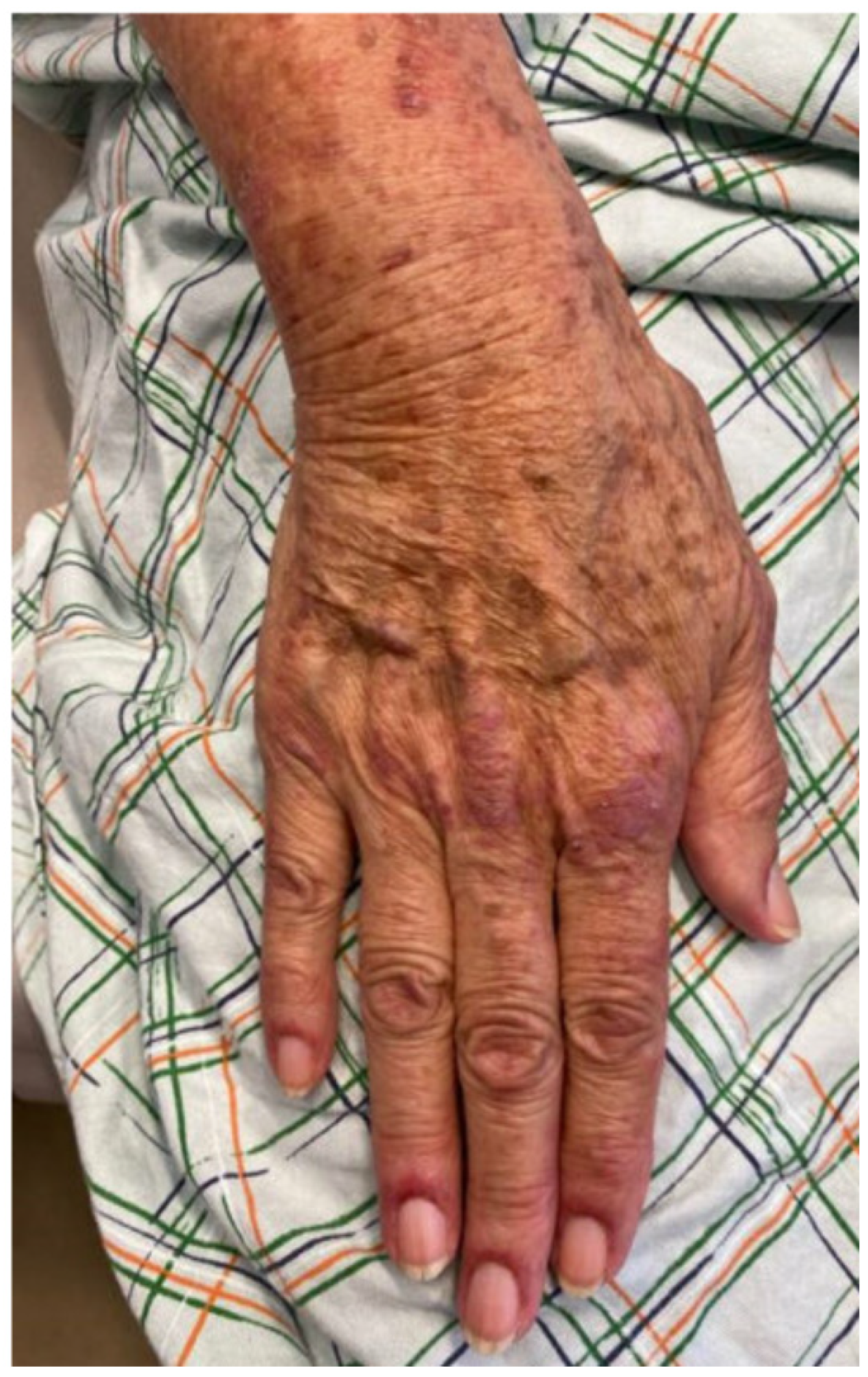 Dermato 03 00018 g003