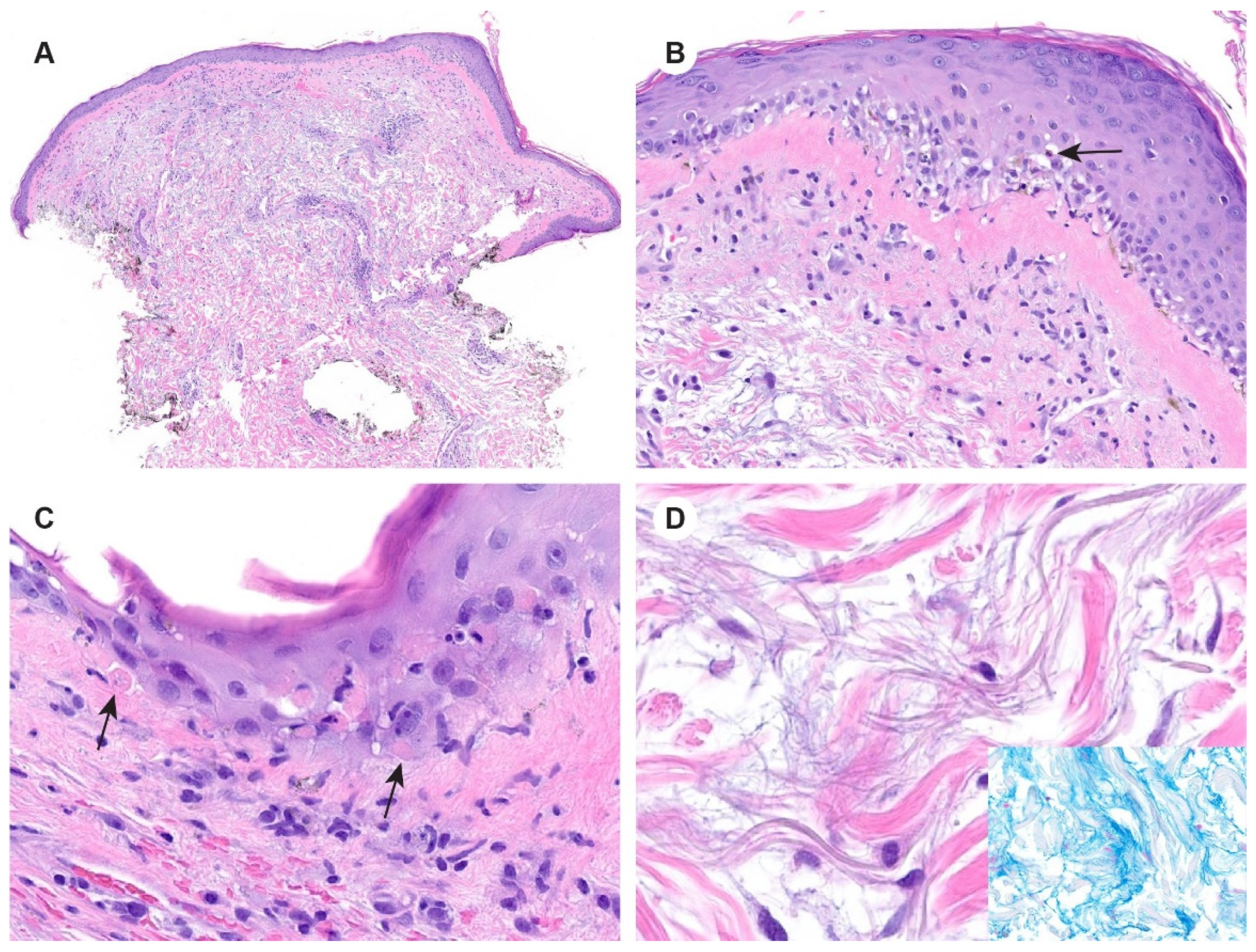 Dermato 03 00018 g004